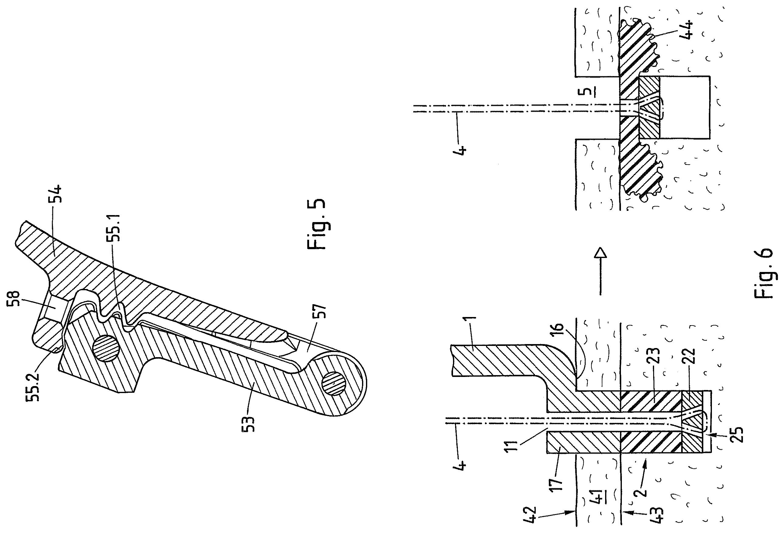 Patent US12569242 Figure 4 – Device and method for fixating a suture anchor in hard tissue