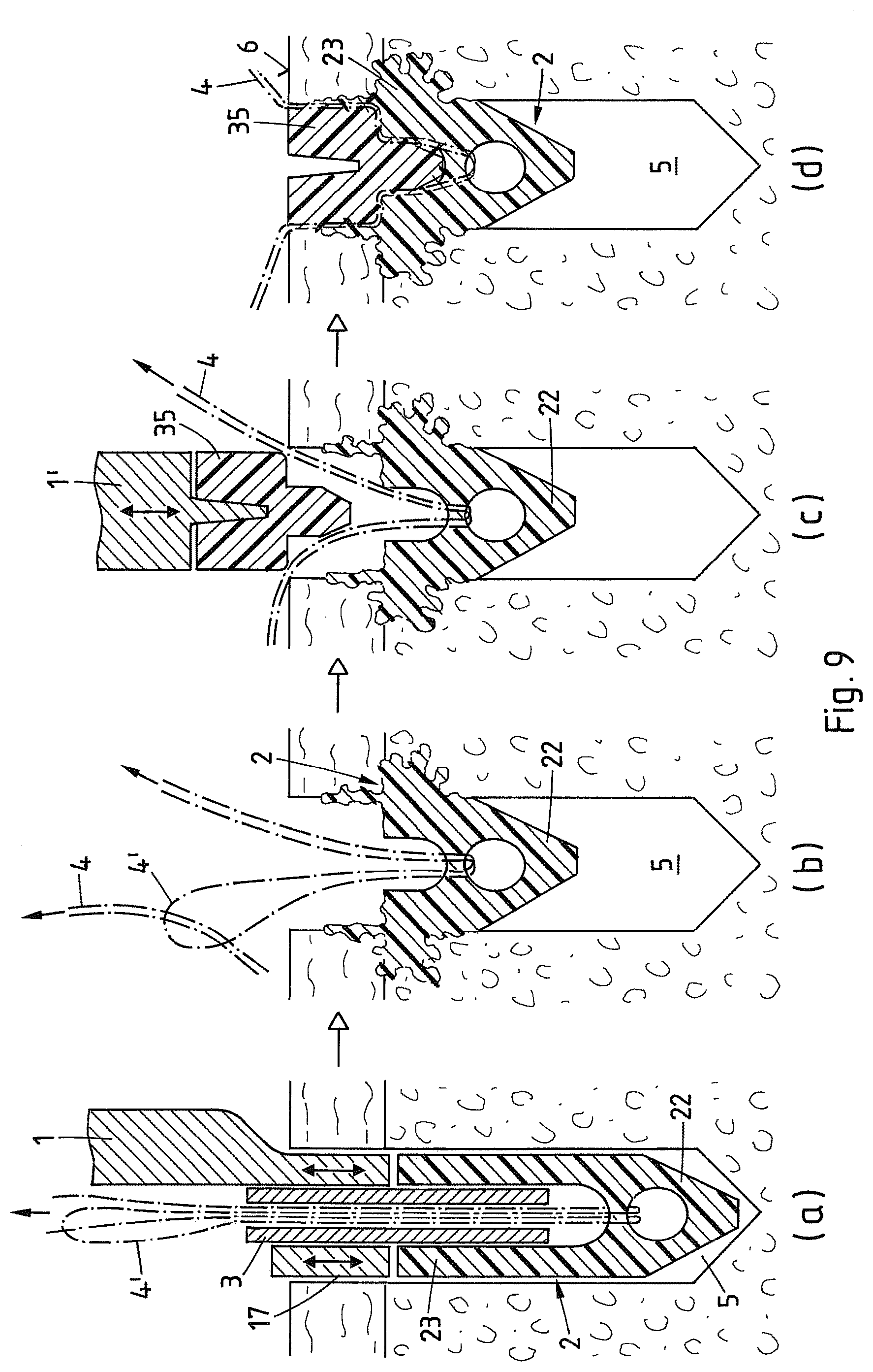 Patent US12569242 Figure 6 – Device and method for fixating a suture anchor in hard tissue