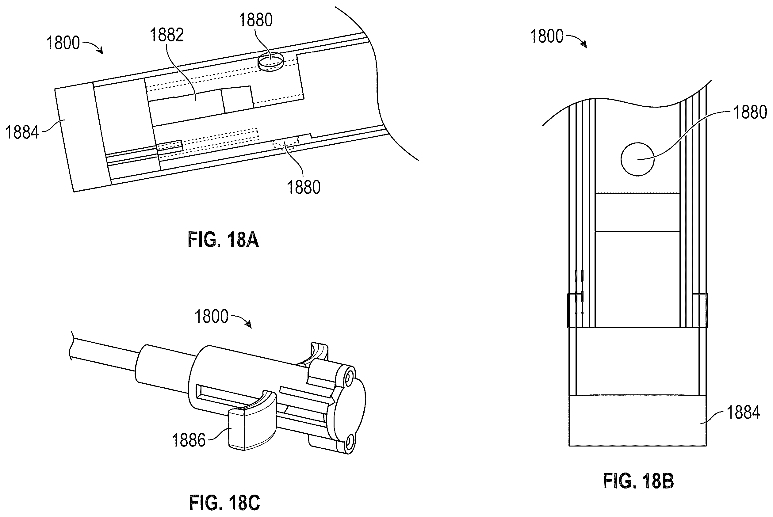 Patent US12569243 Figure 17 – Systems for percutaneous ventriculoplasty using ventricular anchors