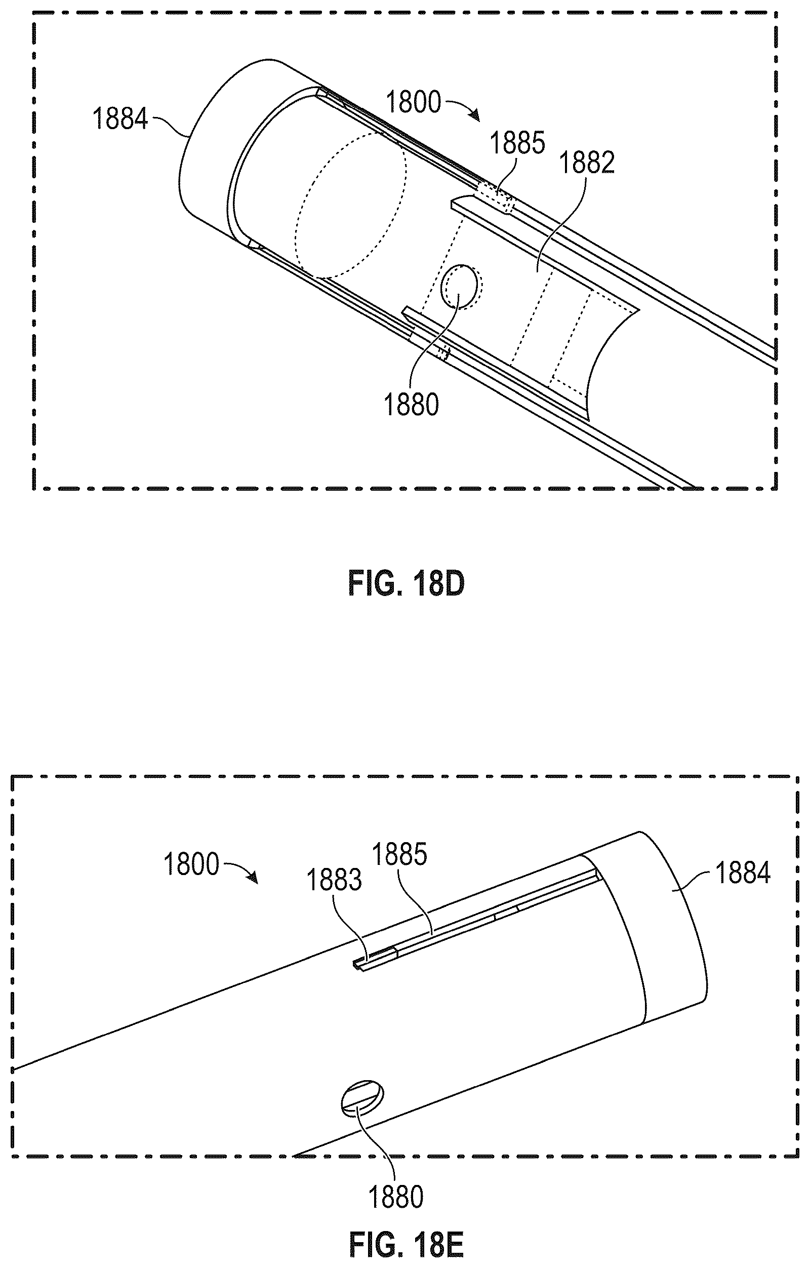 Patent US12569243 Figure 18 – Systems for percutaneous ventriculoplasty using ventricular anchors