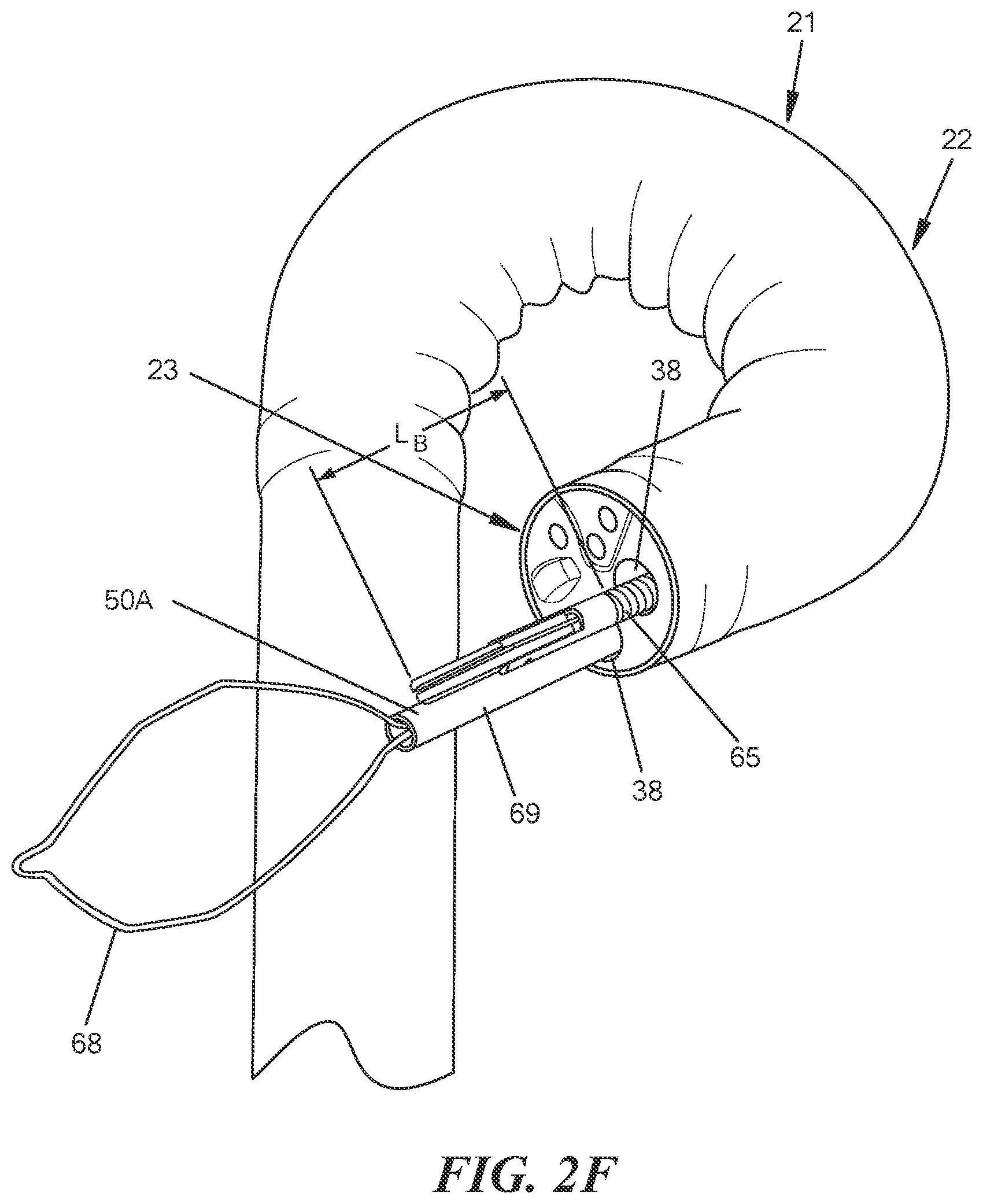 Patent US12569244 Figure 6 – Endoscopic suture cutter