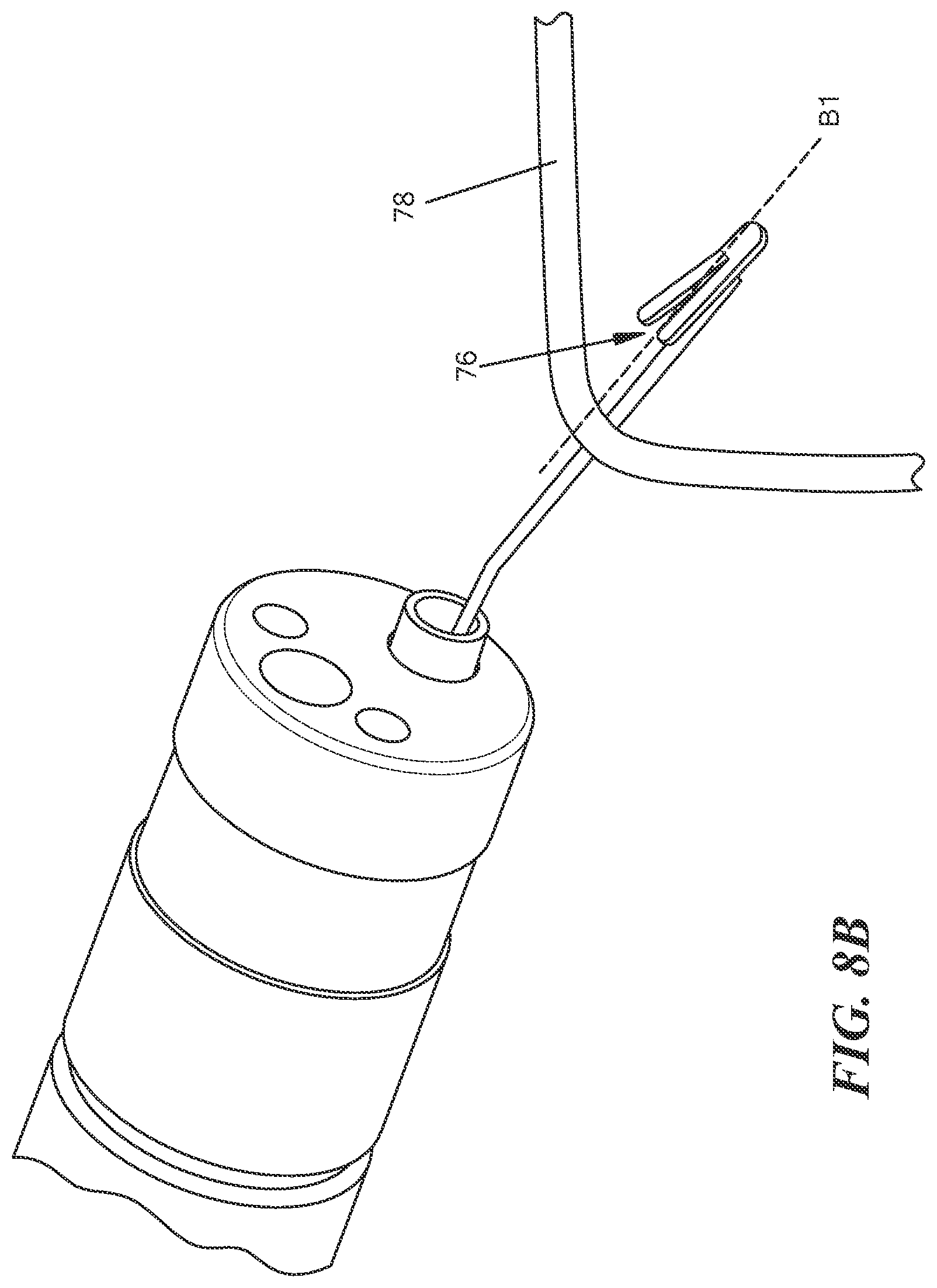 Patent US12569244 Figure 15 – Endoscopic suture cutter