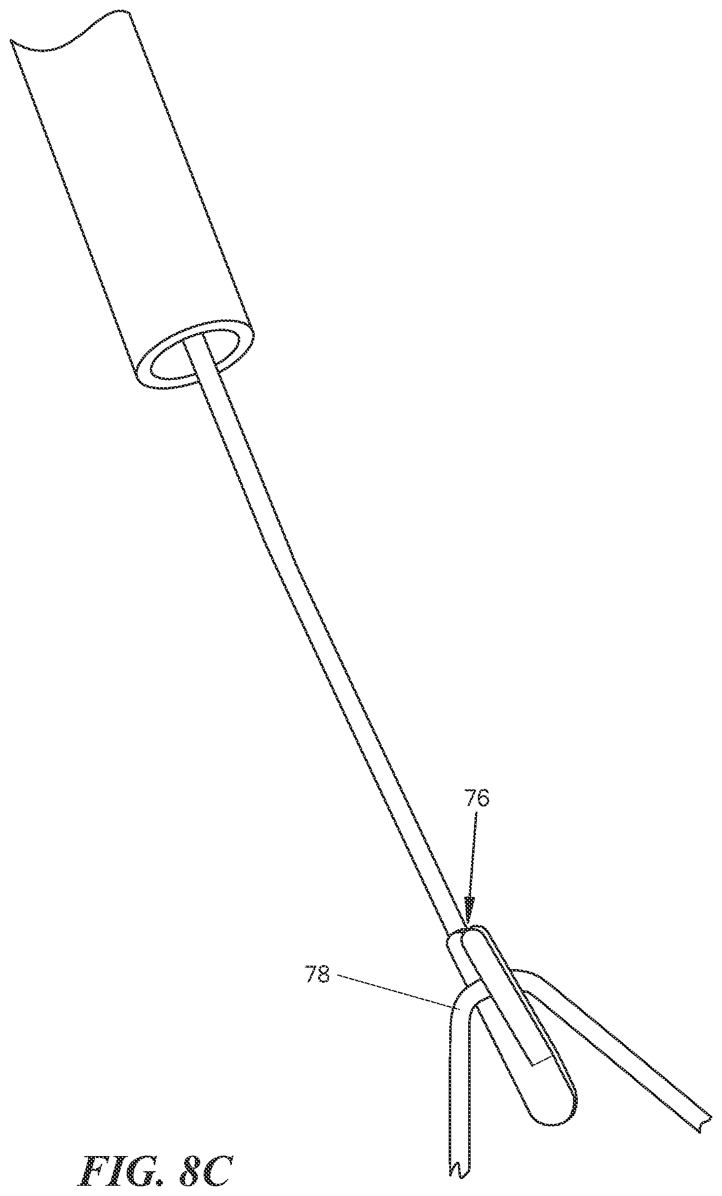 Patent US12569244 Figure 16 – Endoscopic suture cutter