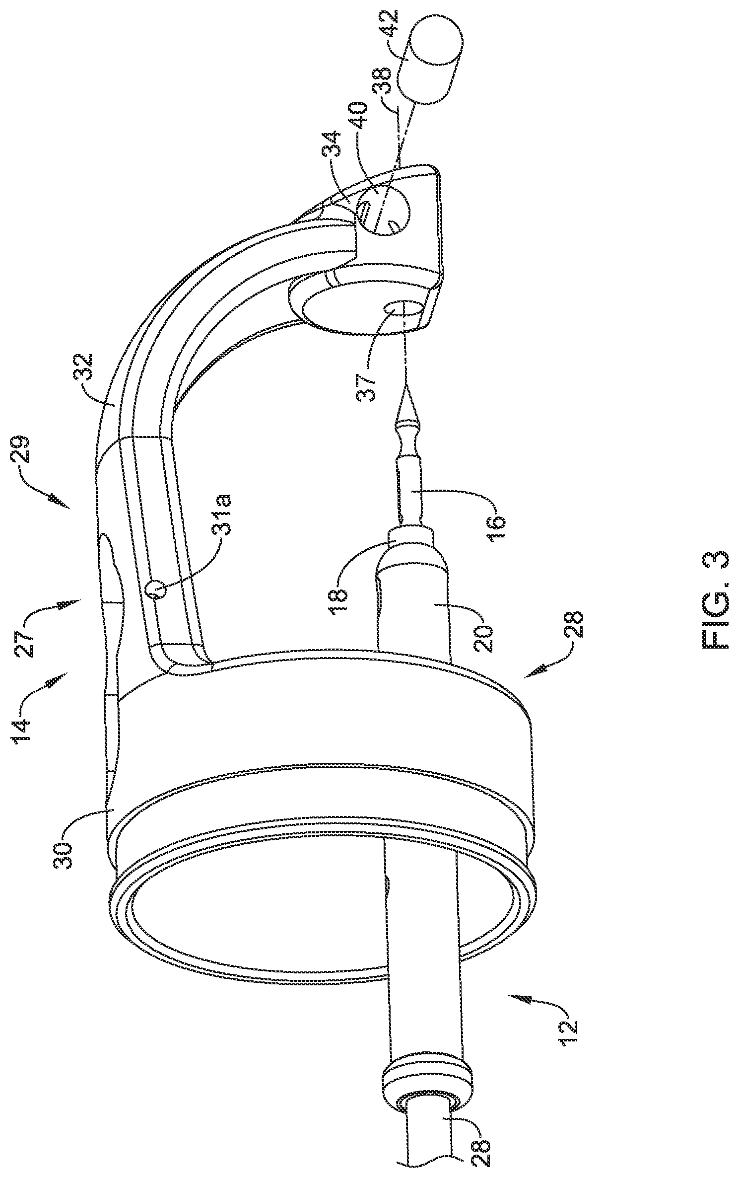 Patent US12569245 Figure 3 – Suture based closure device