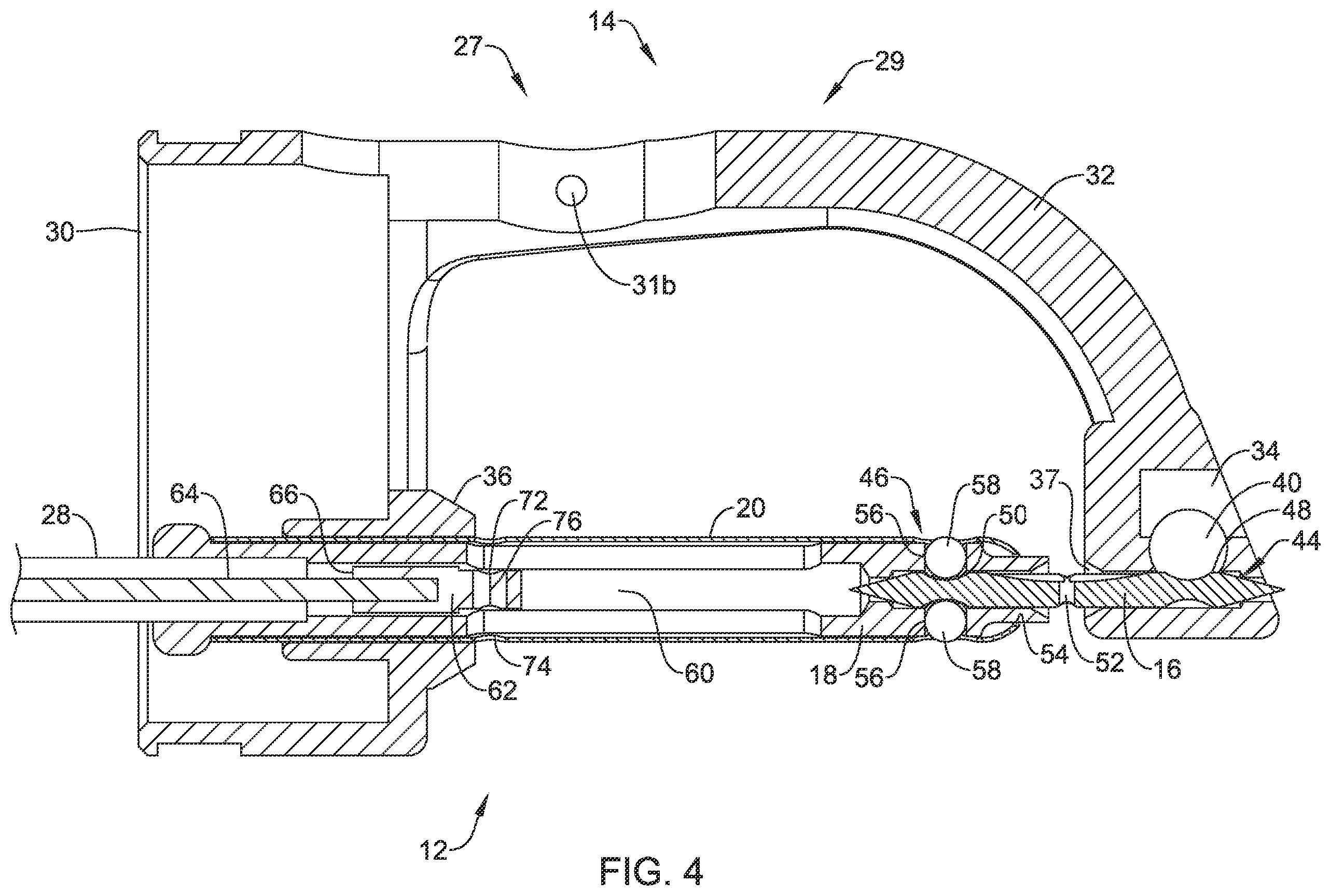 Patent US12569245 Figure 4 – Suture based closure device