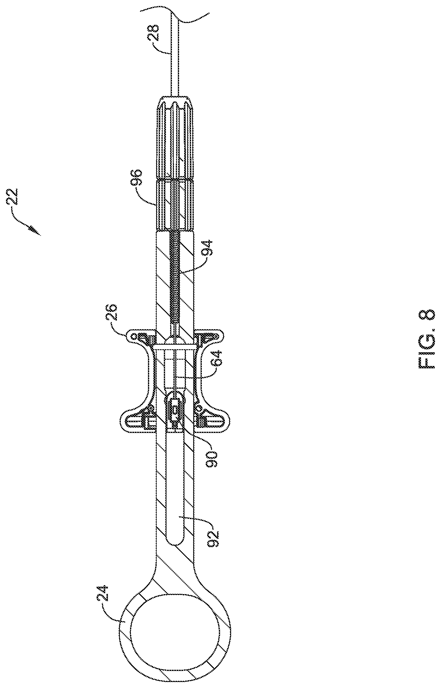 Patent US12569245 Figure 9 – Suture based closure device