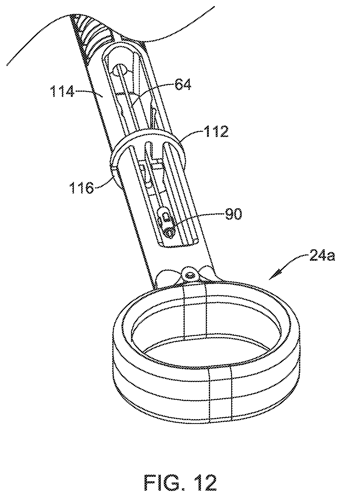Patent US12569245 Figure 14 – Suture based closure device