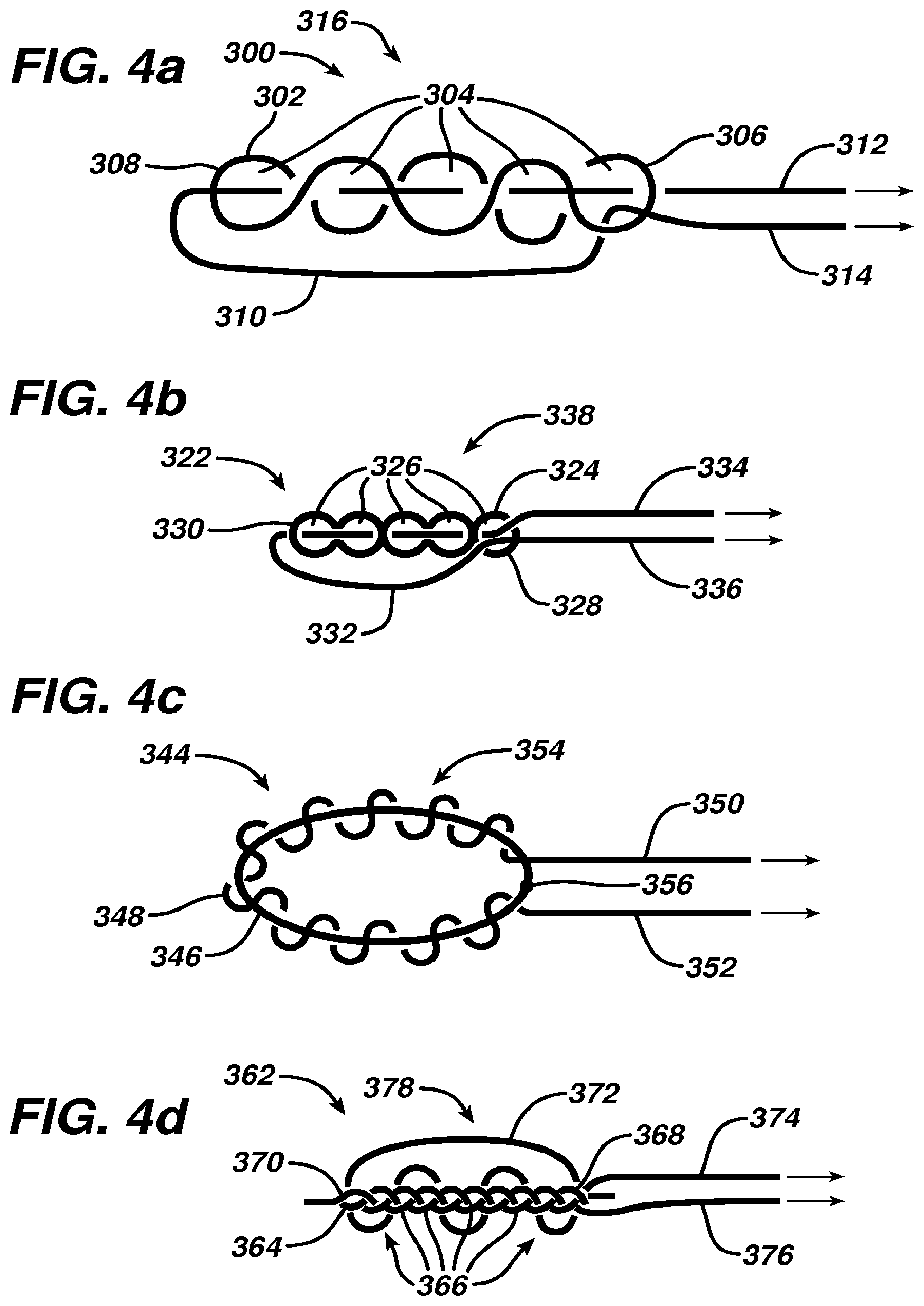Patent US12569246 Figure 4 – Methods and devices for repairing and anchoring damaged tissue