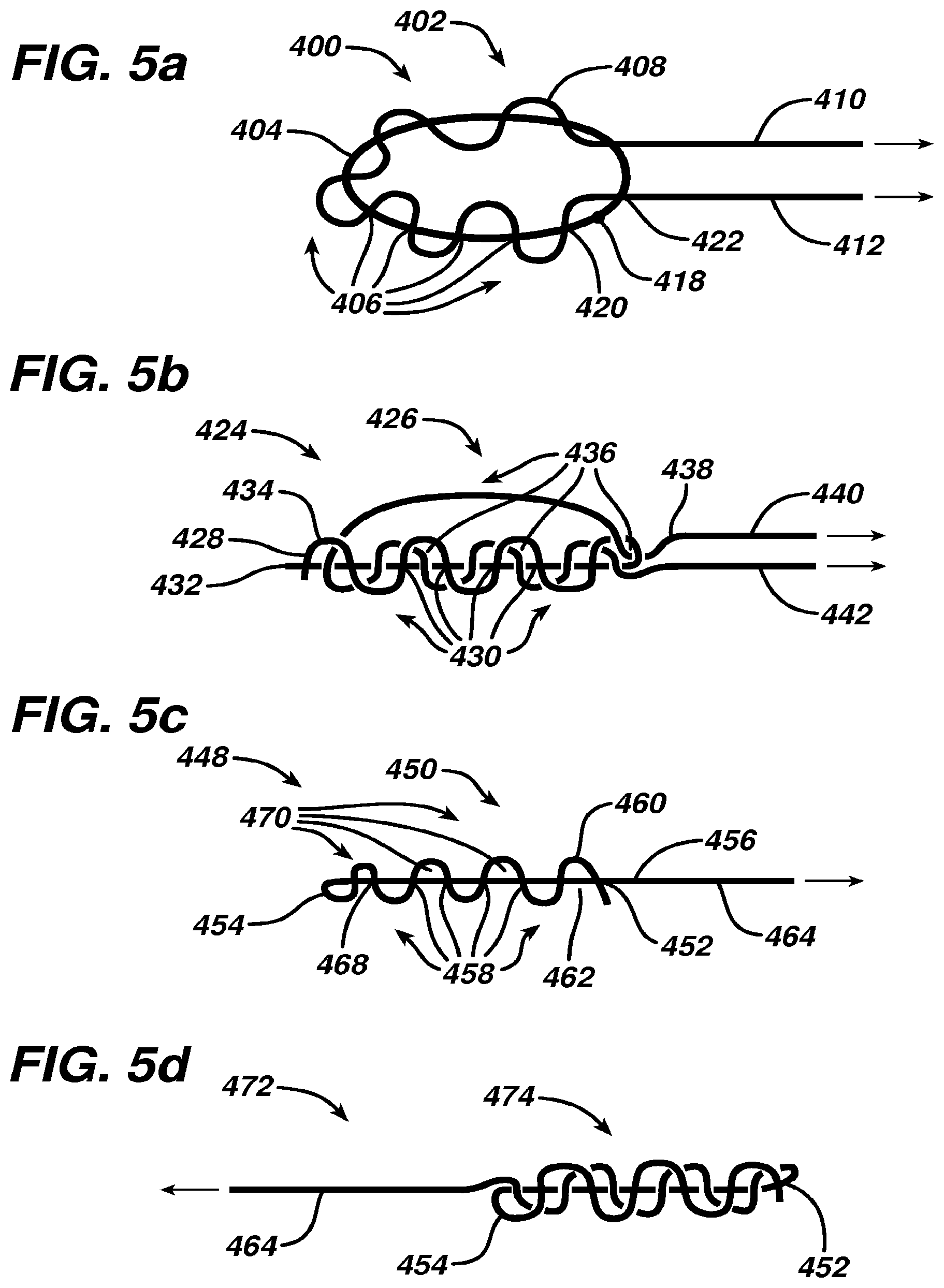 Patent US12569246 Figure 5 – Methods and devices for repairing and anchoring damaged tissue