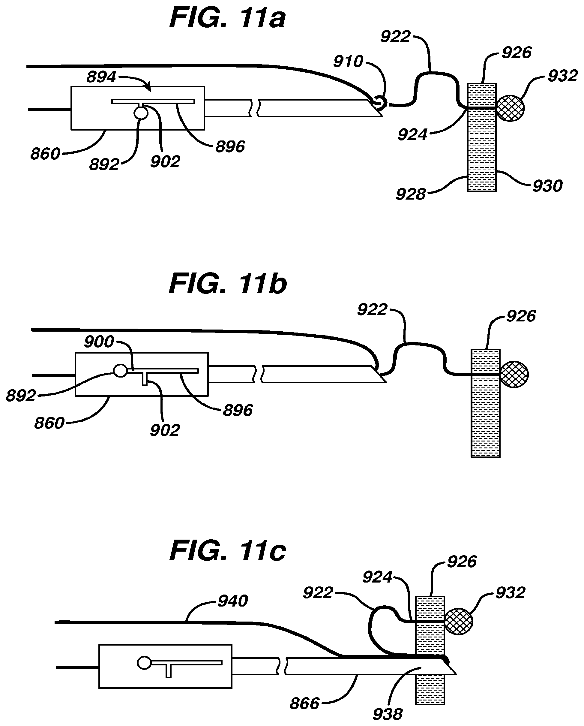 Patent US12569246 Figure 14 – Methods and devices for repairing and anchoring damaged tissue