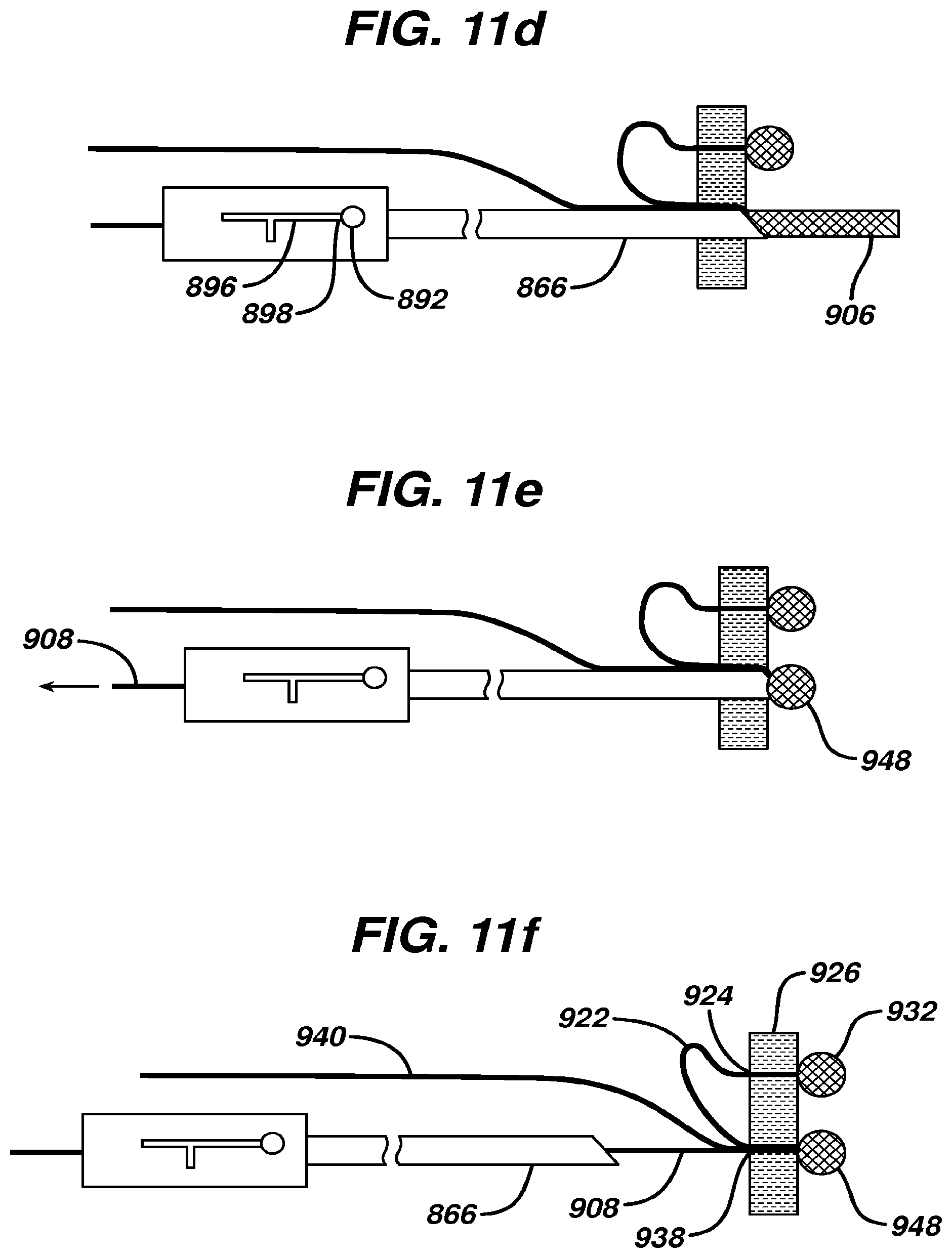 Patent US12569246 Figure 15 – Methods and devices for repairing and anchoring damaged tissue