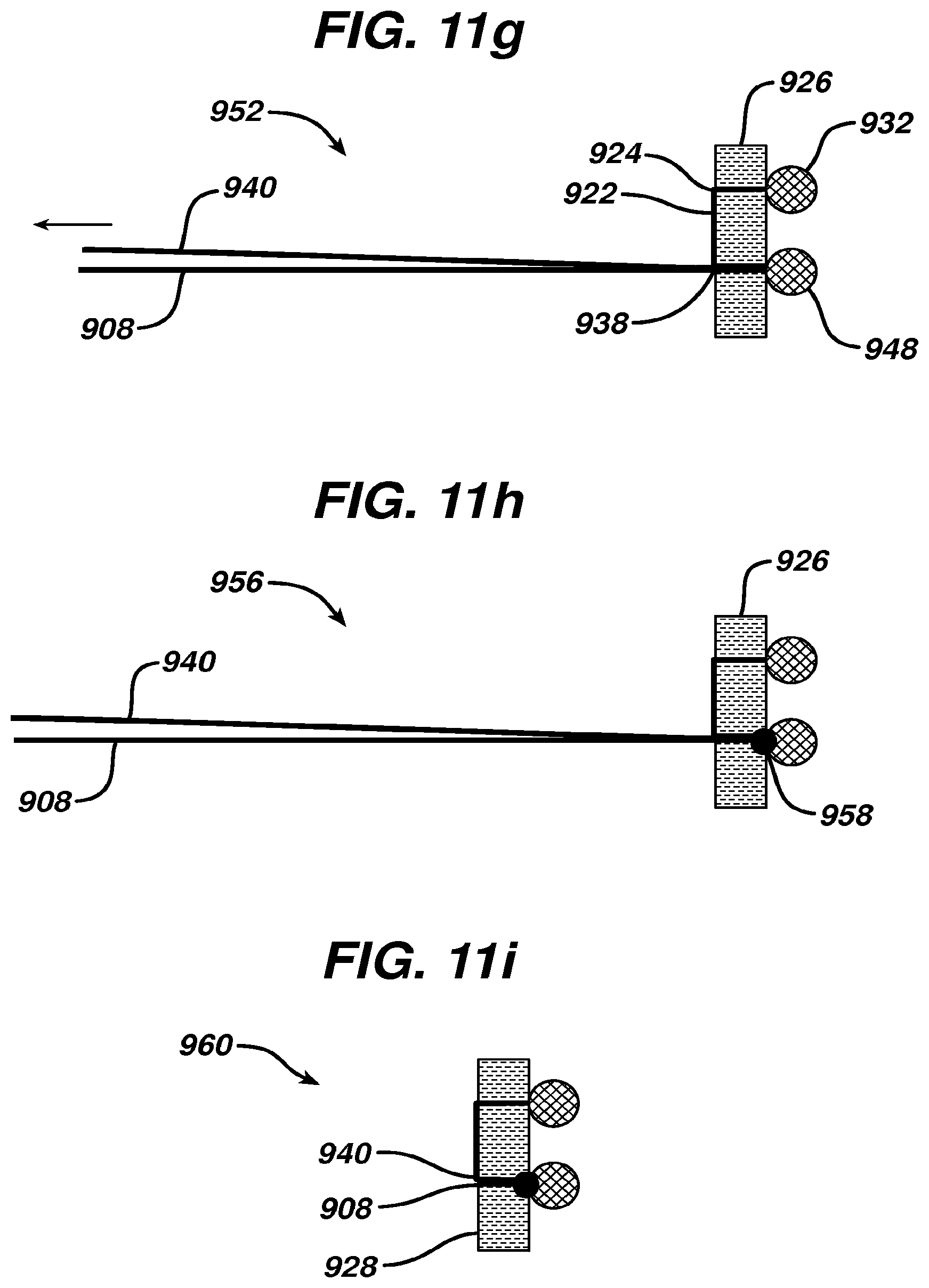 Patent US12569246 Figure 16 – Methods and devices for repairing and anchoring damaged tissue