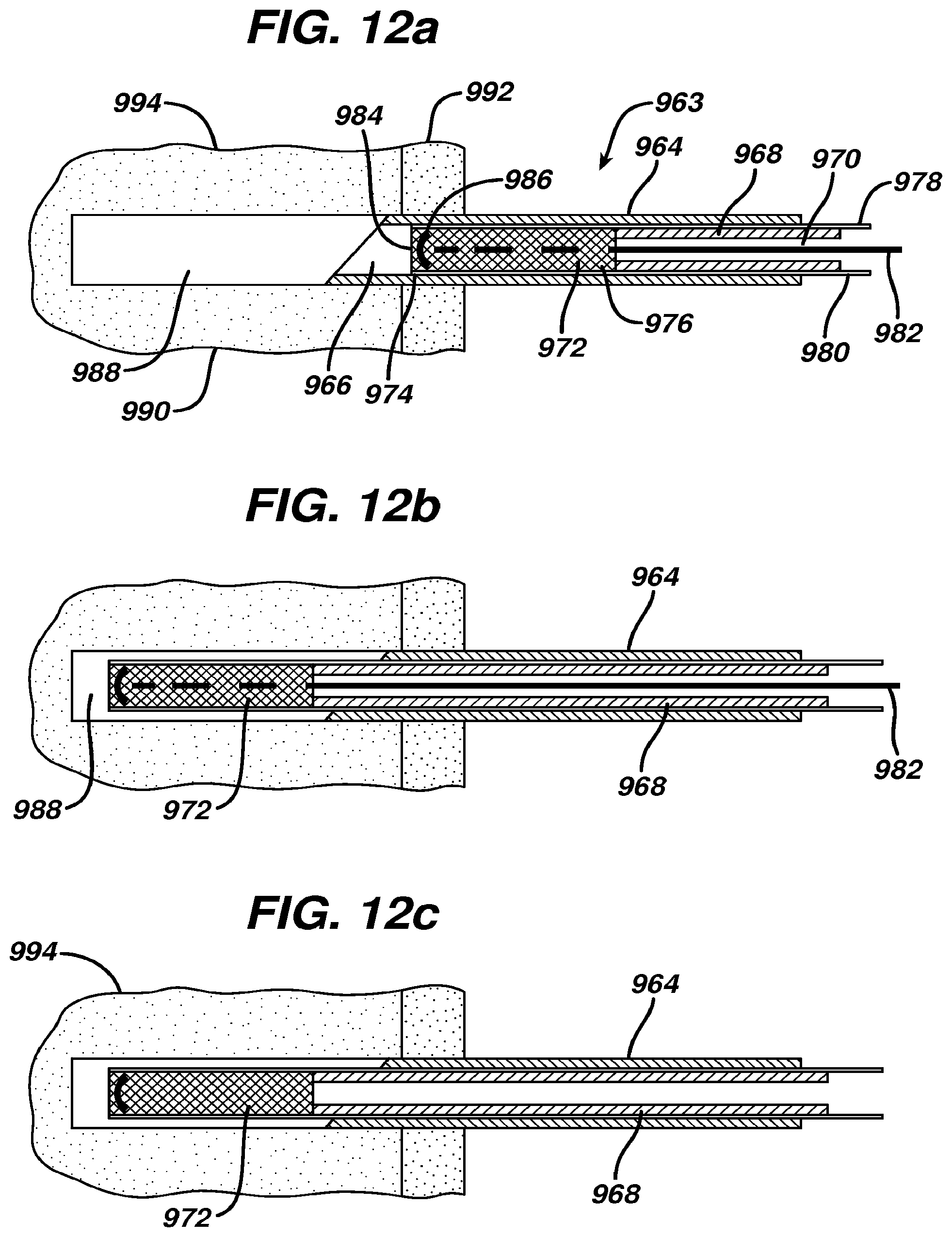 Patent US12569246 Figure 17 – Methods and devices for repairing and anchoring damaged tissue