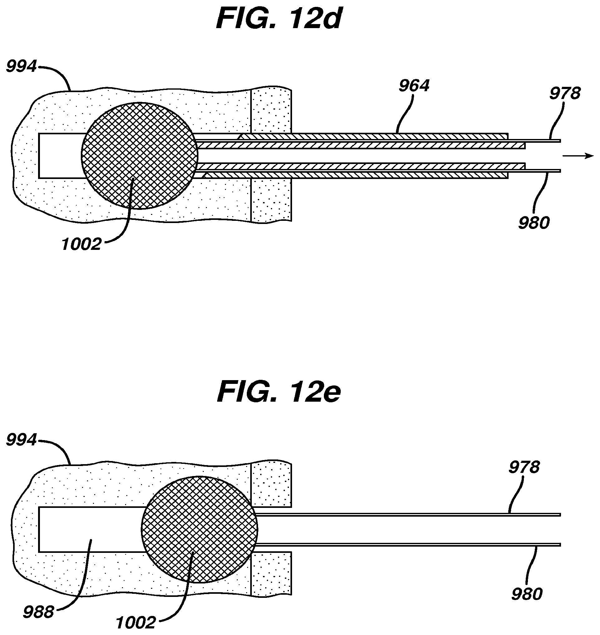Patent US12569246 Figure 18 – Methods and devices for repairing and anchoring damaged tissue