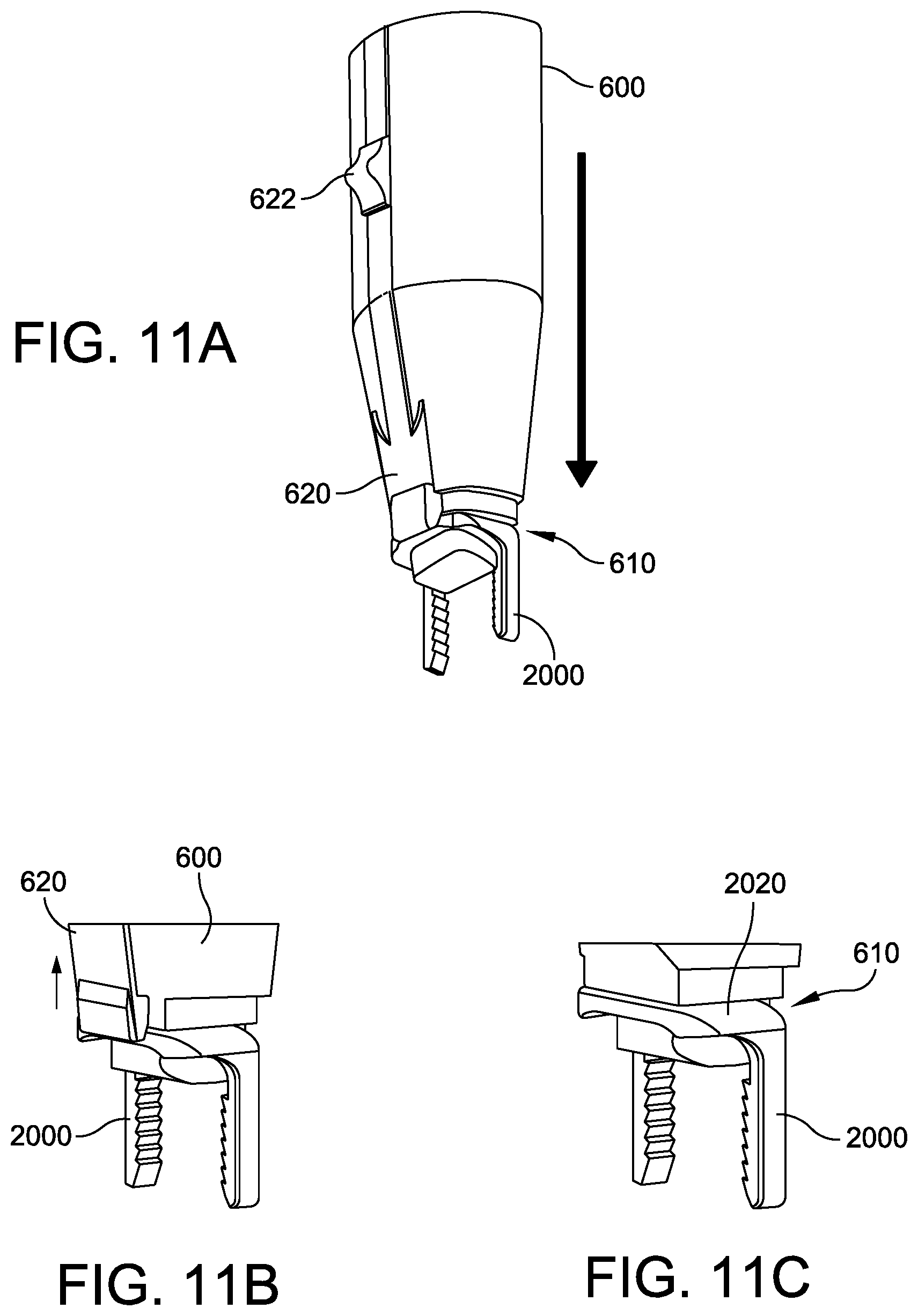 Patent US12569248 Figure 17 – Orthopedic staple and related instruments