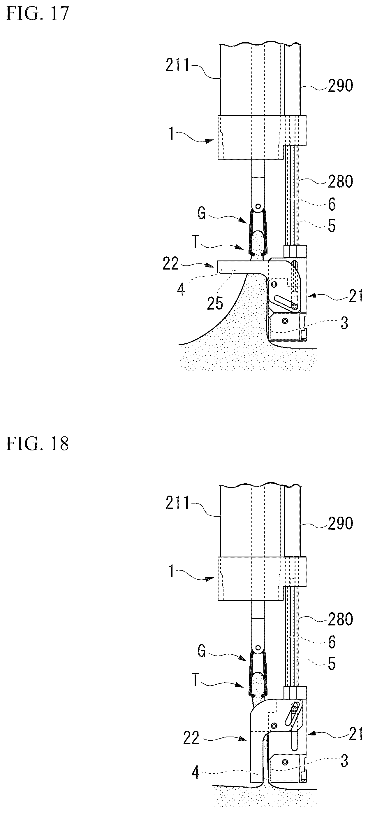 Patent US12569249 Figure 11 – Medical stapler
