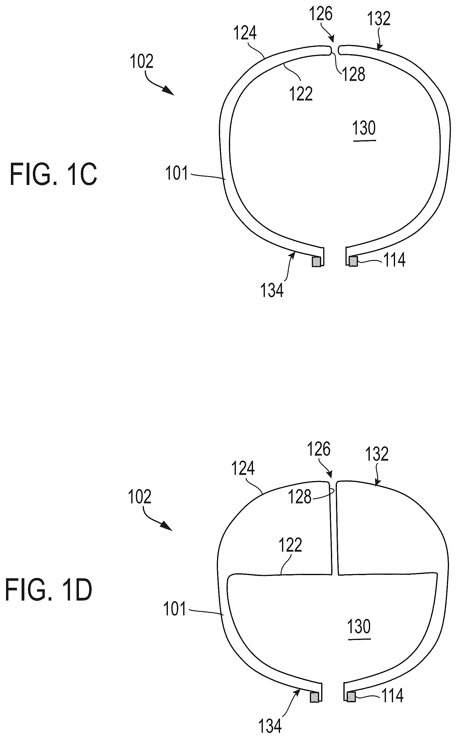 Patent US12569252 Figure 3 – Systems and methods for treating aneurysms