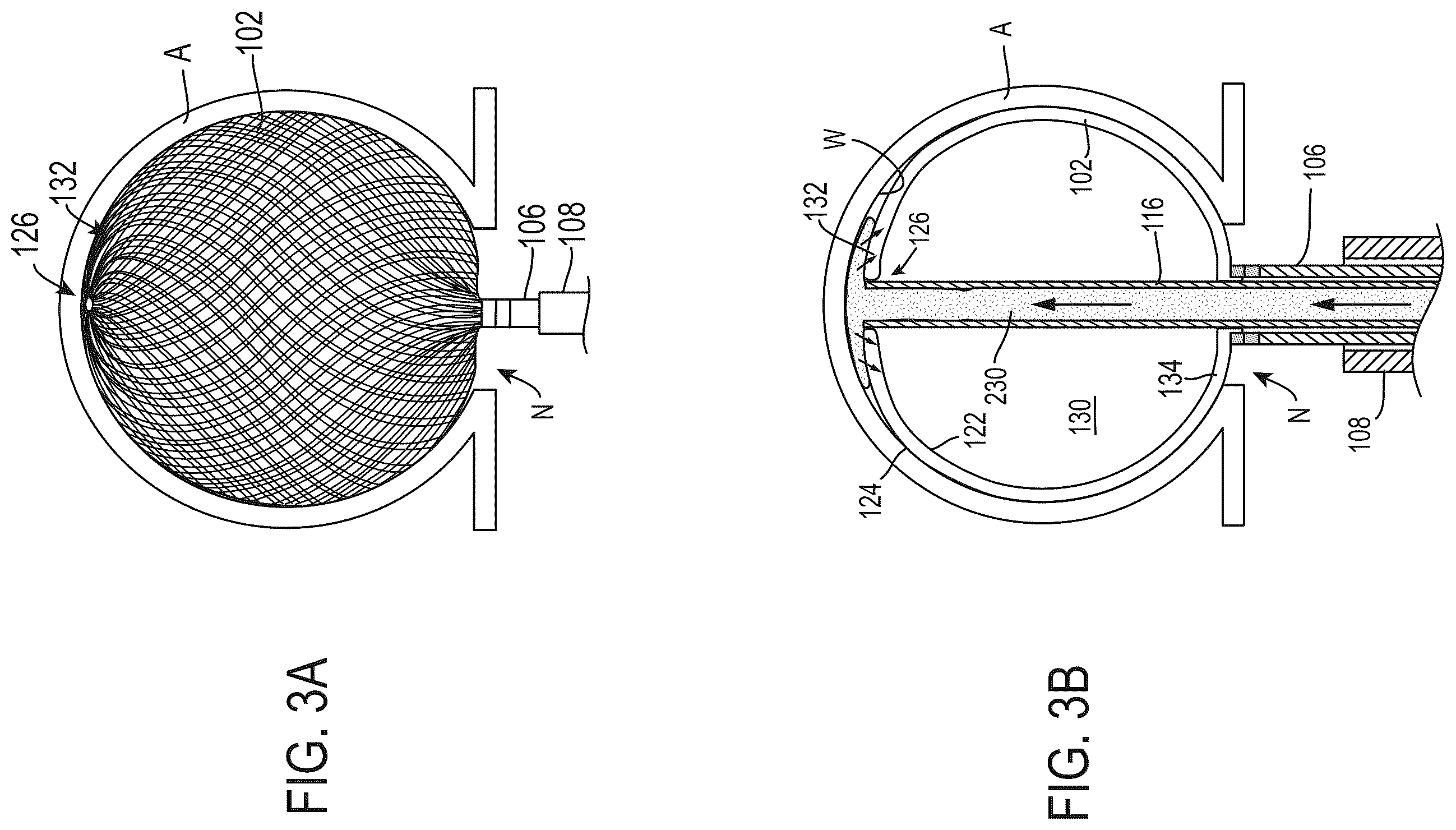 Patent US12569252 Figure 5 – Systems and methods for treating aneurysms