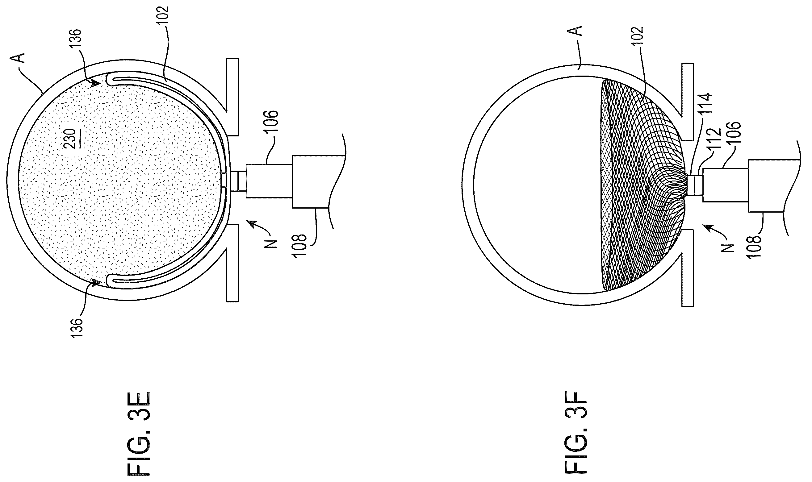 Patent US12569252 Figure 7 – Systems and methods for treating aneurysms