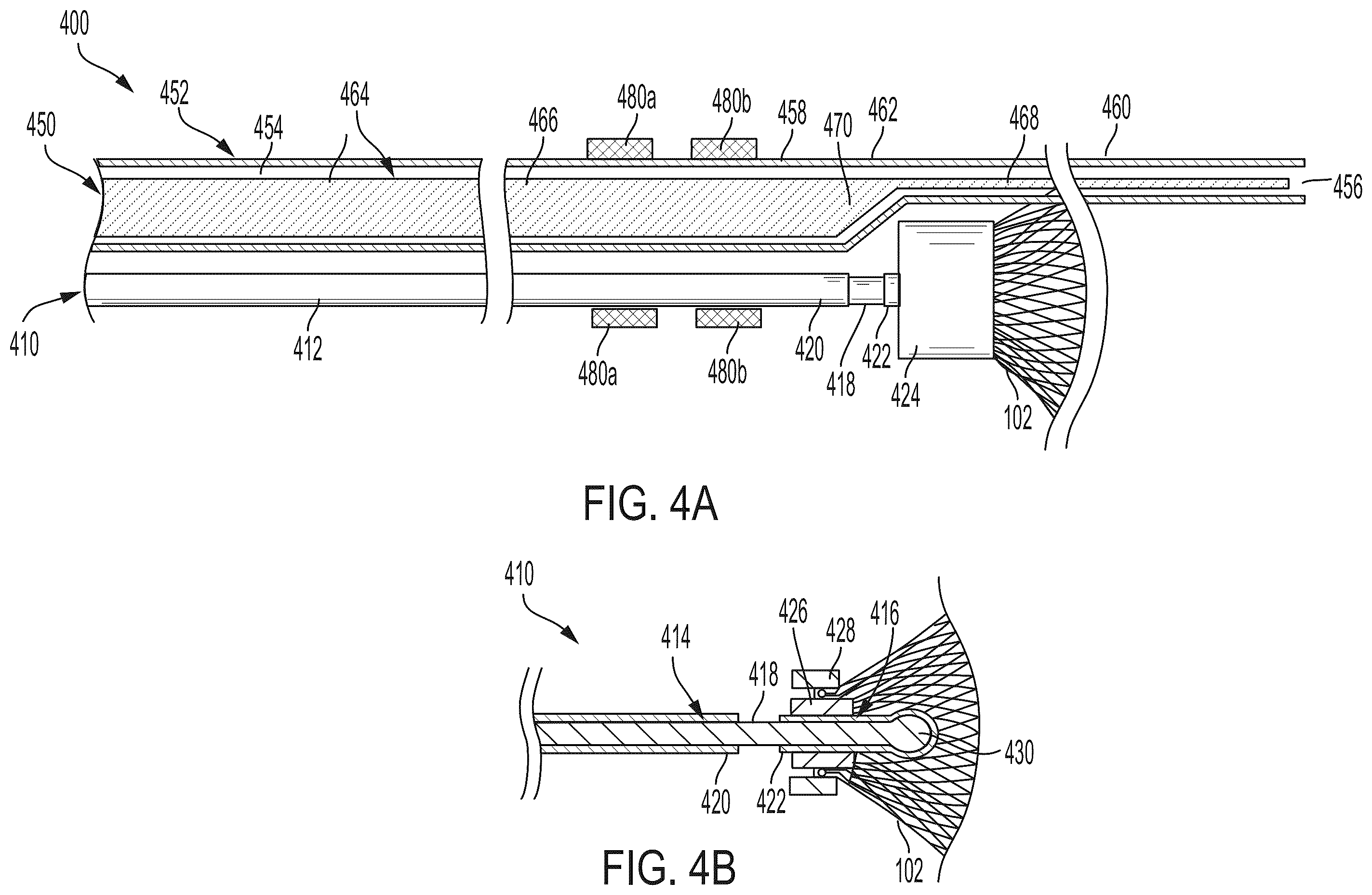 Patent US12569252 Figure 9 – Systems and methods for treating aneurysms