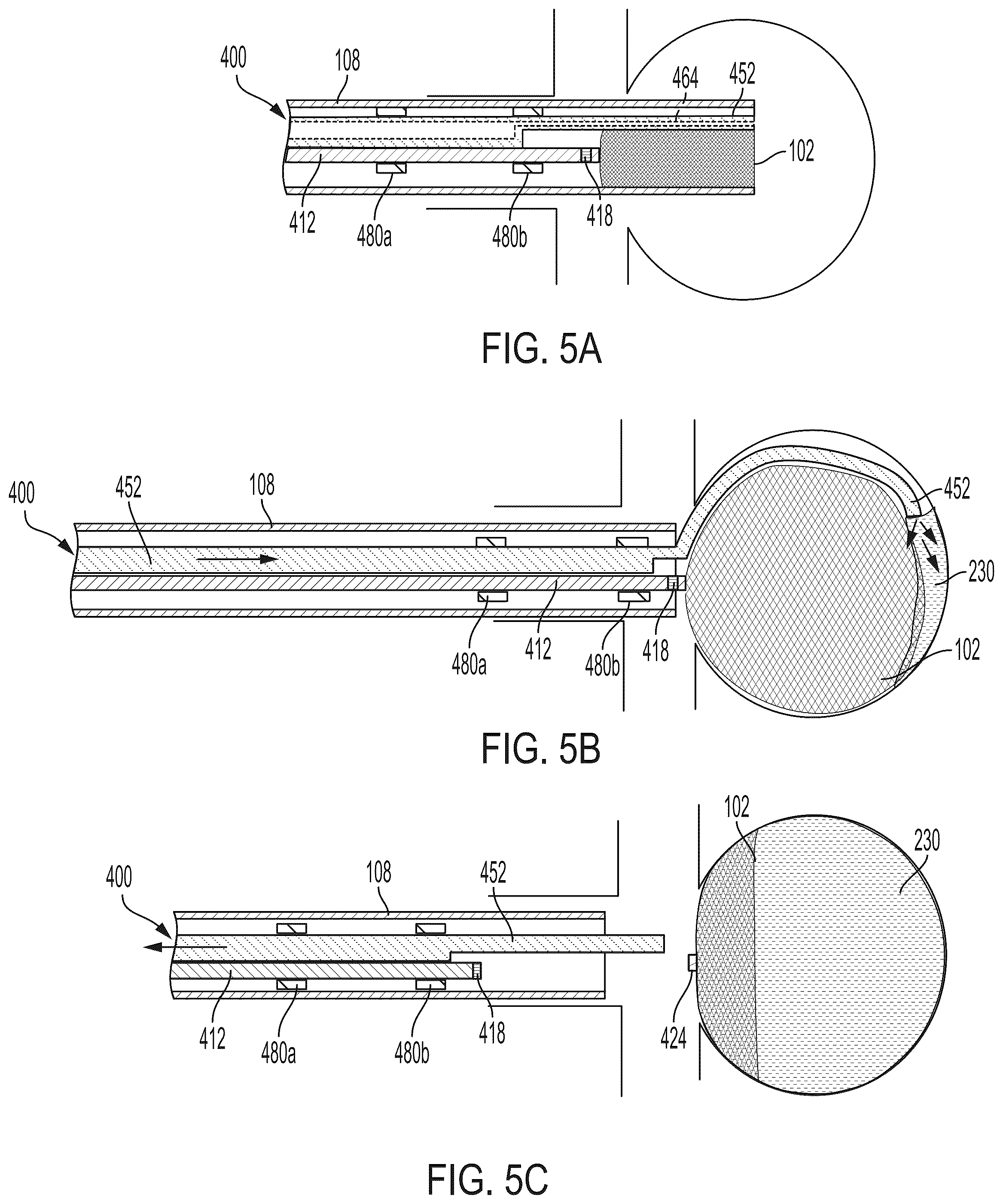 Patent US12569252 Figure 10 – Systems and methods for treating aneurysms