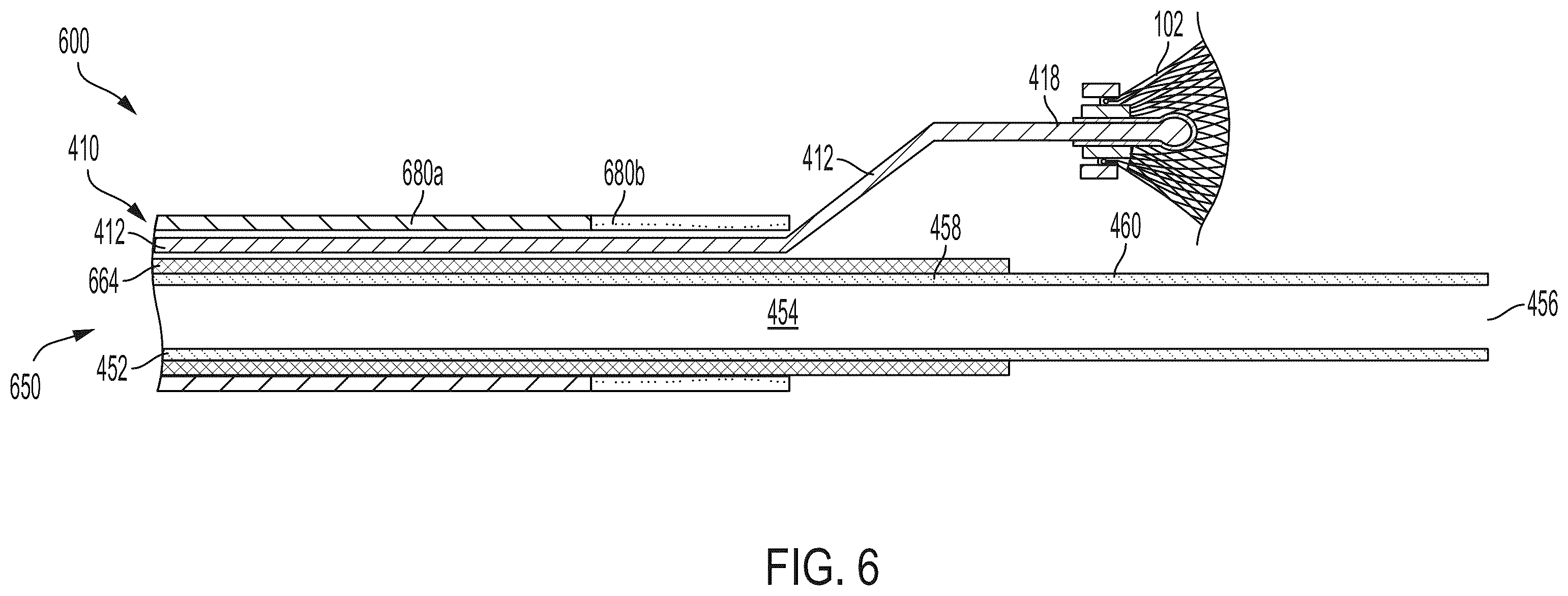 Patent US12569252 Figure 11 – Systems and methods for treating aneurysms