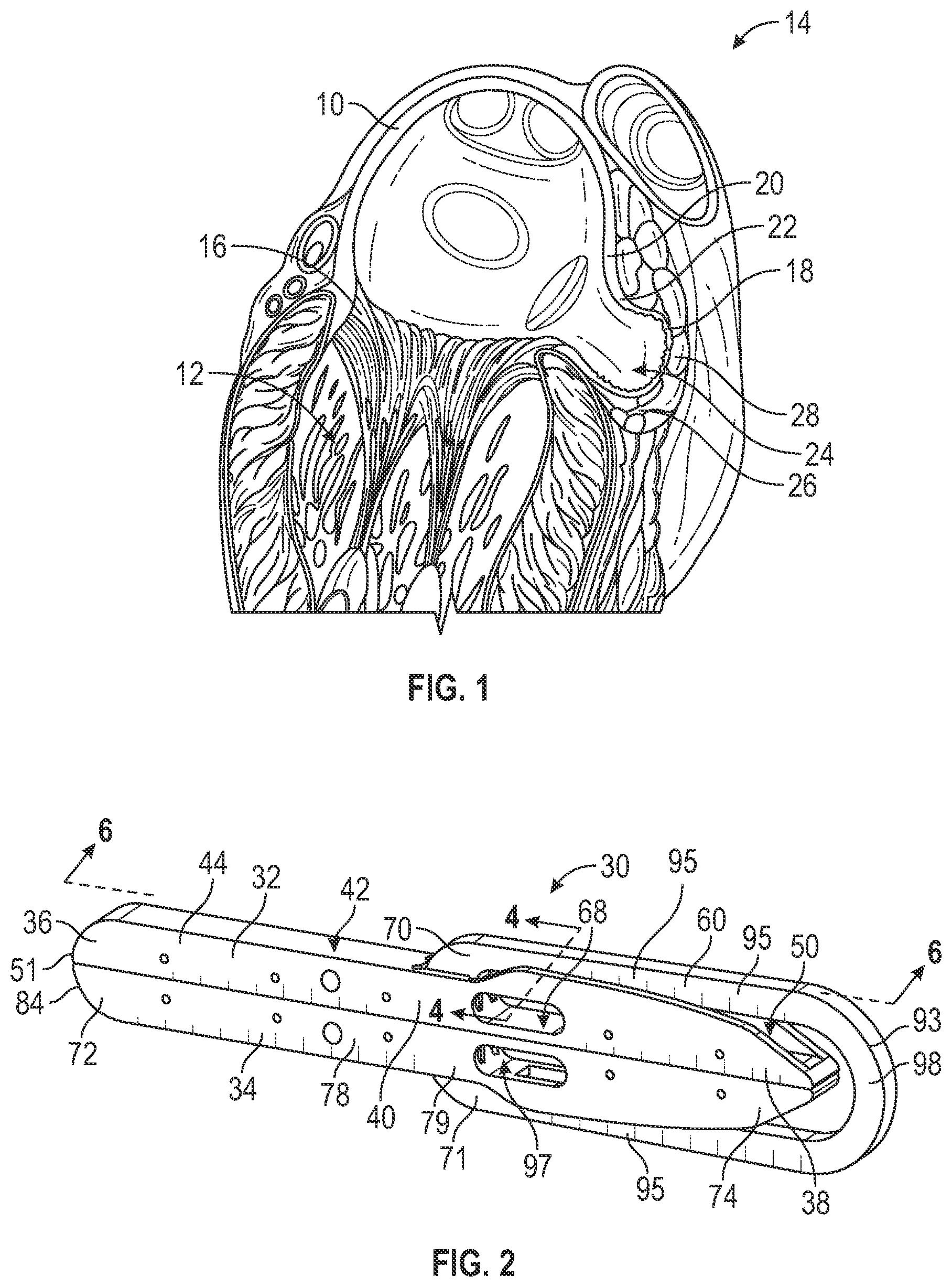 Patent US12569254 Figure 1 – Clip with opposed jaws for left atrial appendage closure