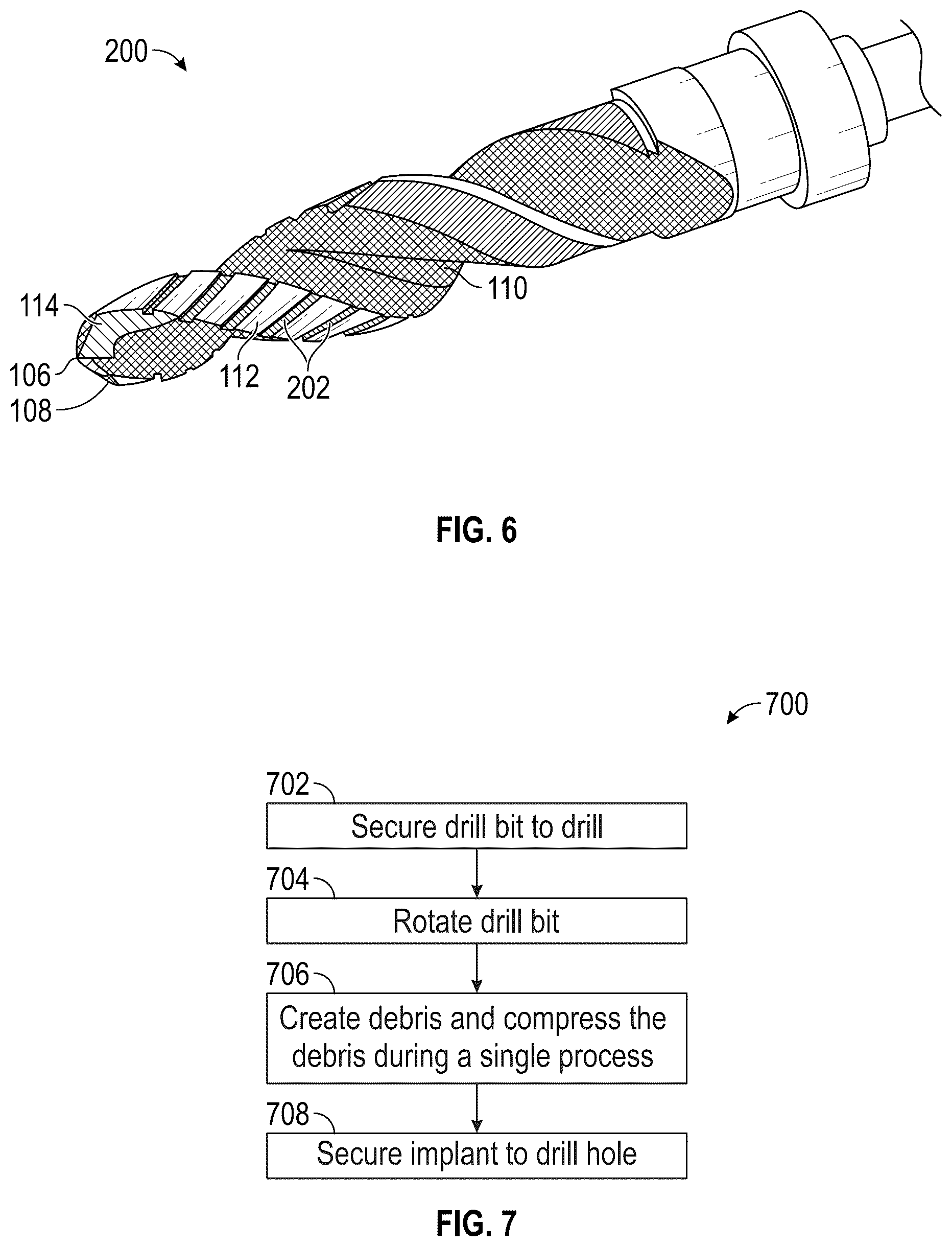 Patent US12569258 Figure 4 – Drill bit-having bone condensation technique