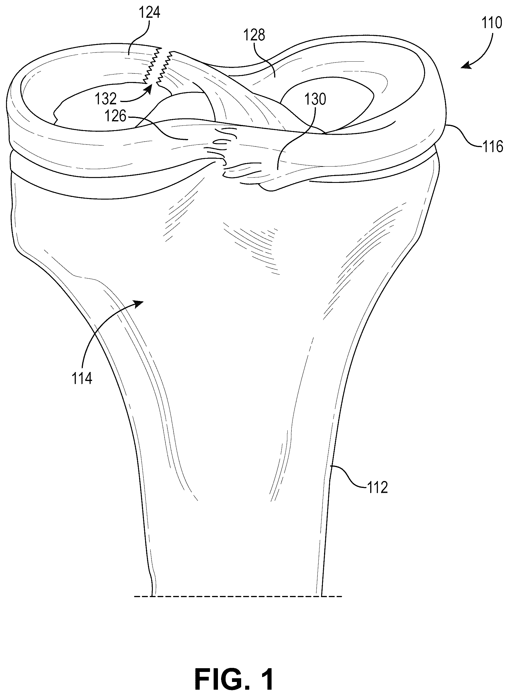 Patent US12569263 Figure 1 – Surgical drill guide apparatus and methods