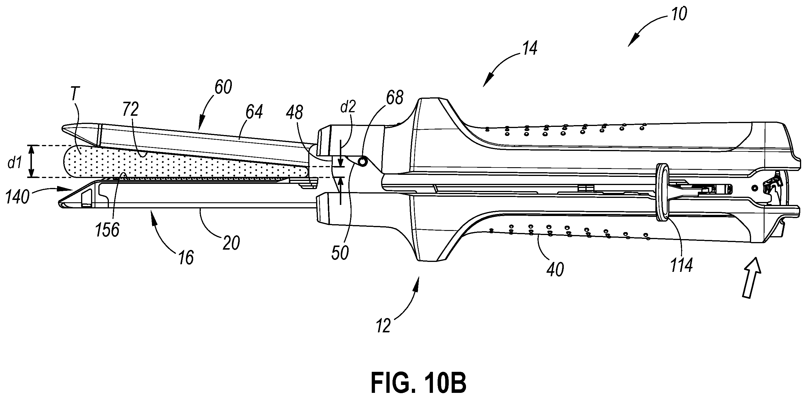 Patent US12569266 Figure 13 – Strain and compression force measurement features for surgical stapler