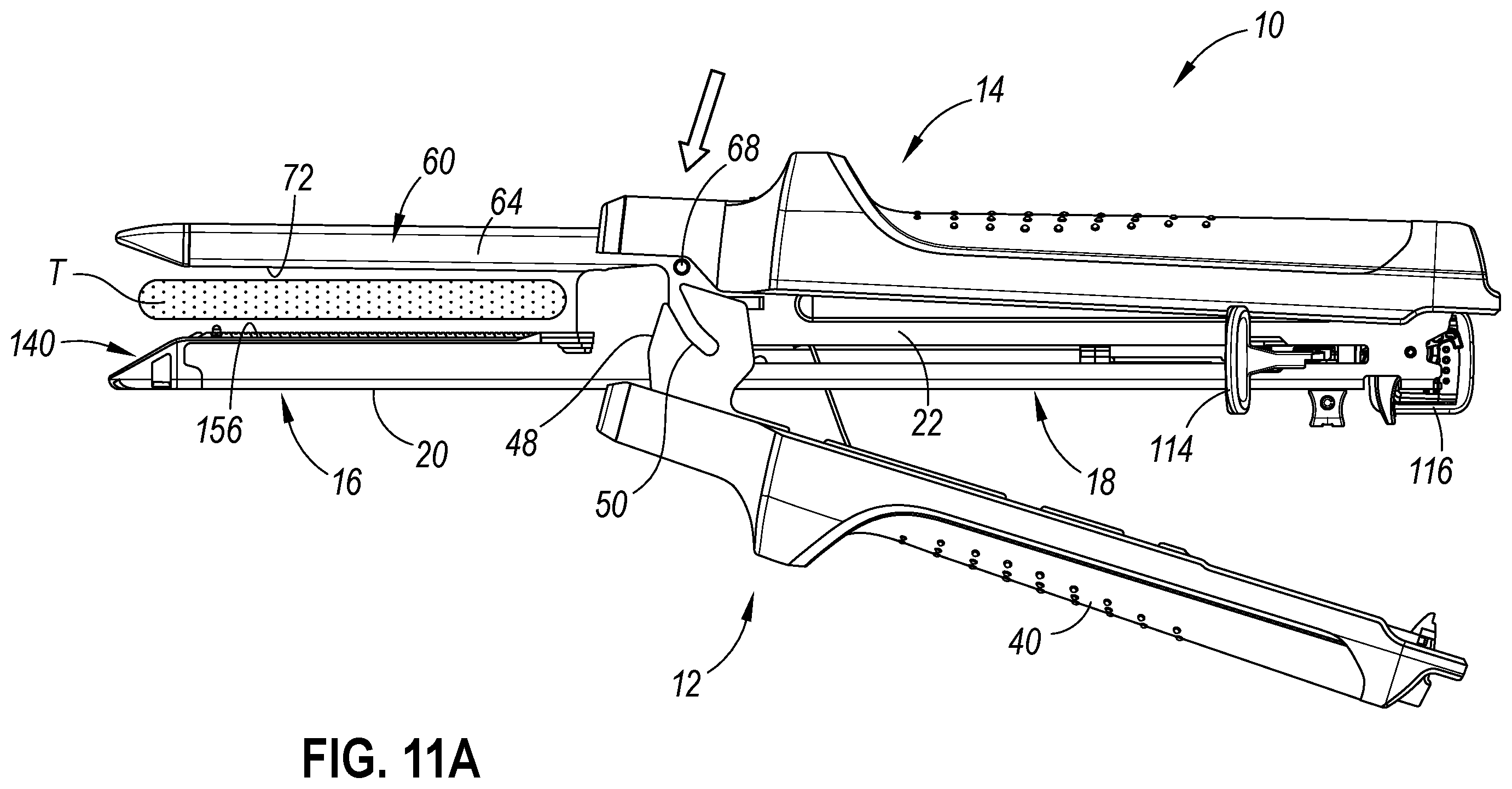 Patent US12569266 Figure 14 – Strain and compression force measurement features for surgical stapler