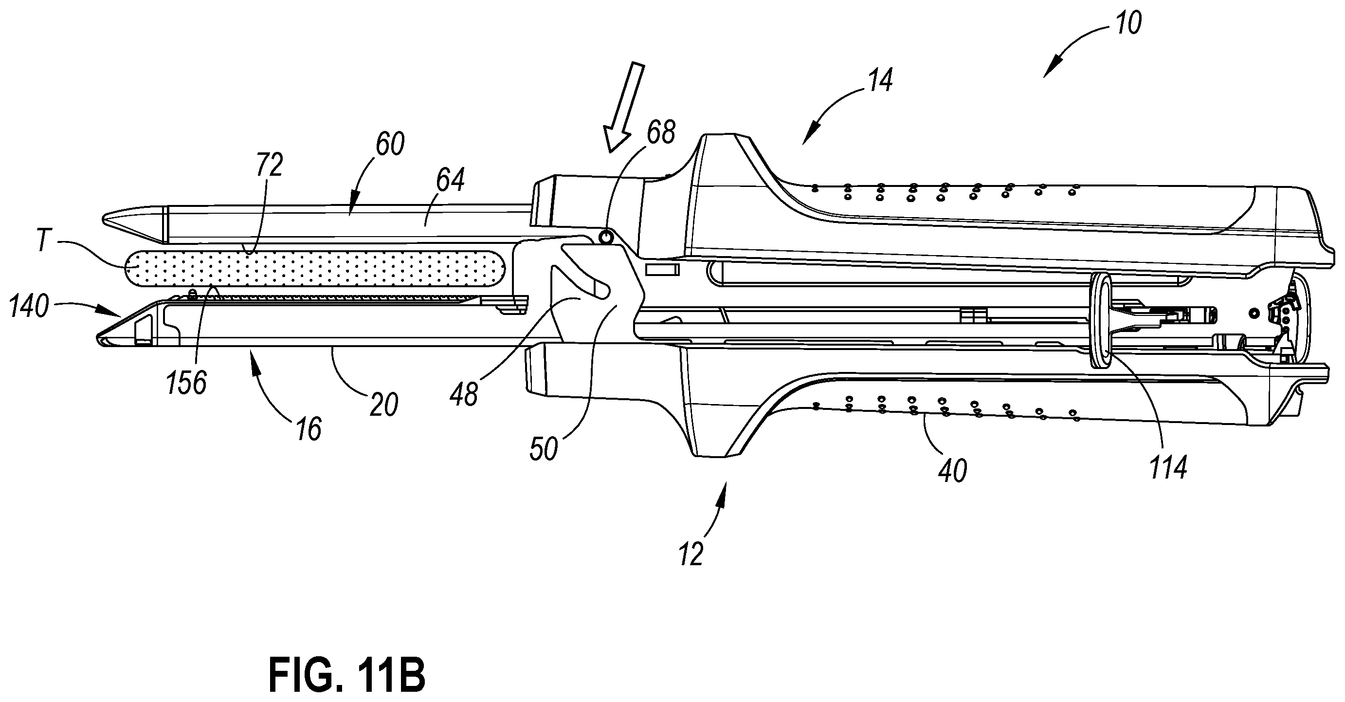 Patent US12569266 Figure 15 – Strain and compression force measurement features for surgical stapler
