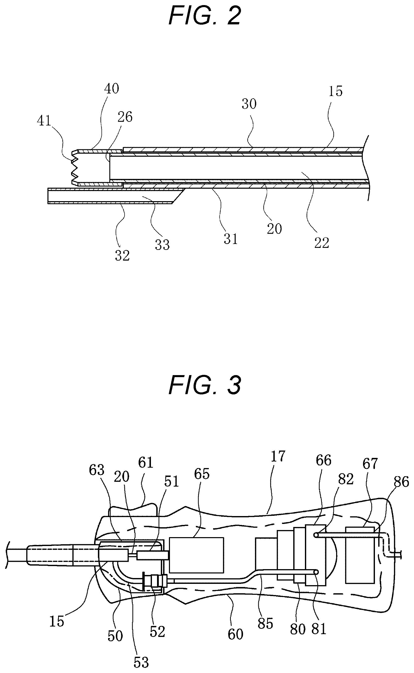 Patent US12569273 Figure 2 – Medical device