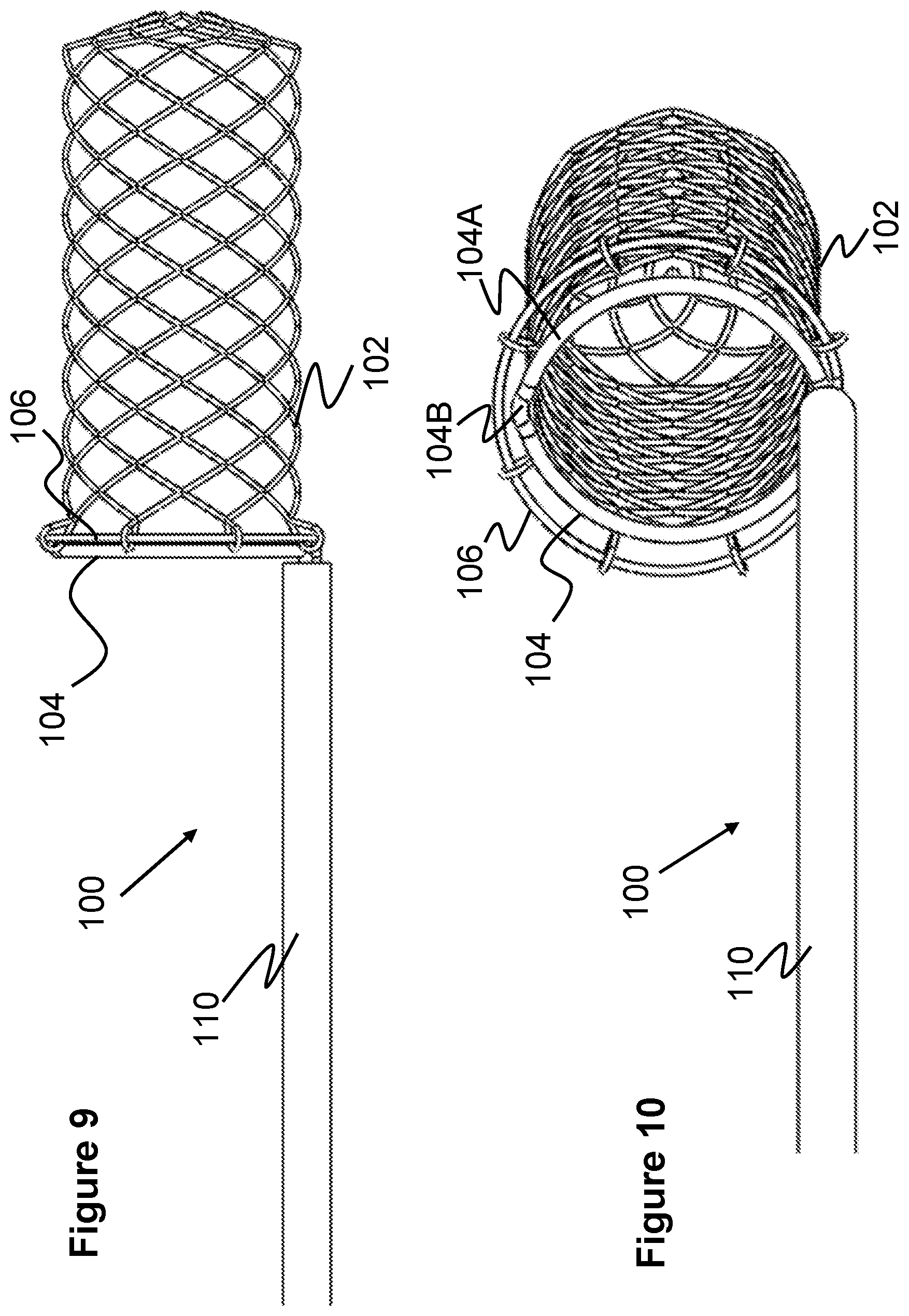 Patent US12569274 Figure 6 – Method and apparatus for removing heart valve therapy