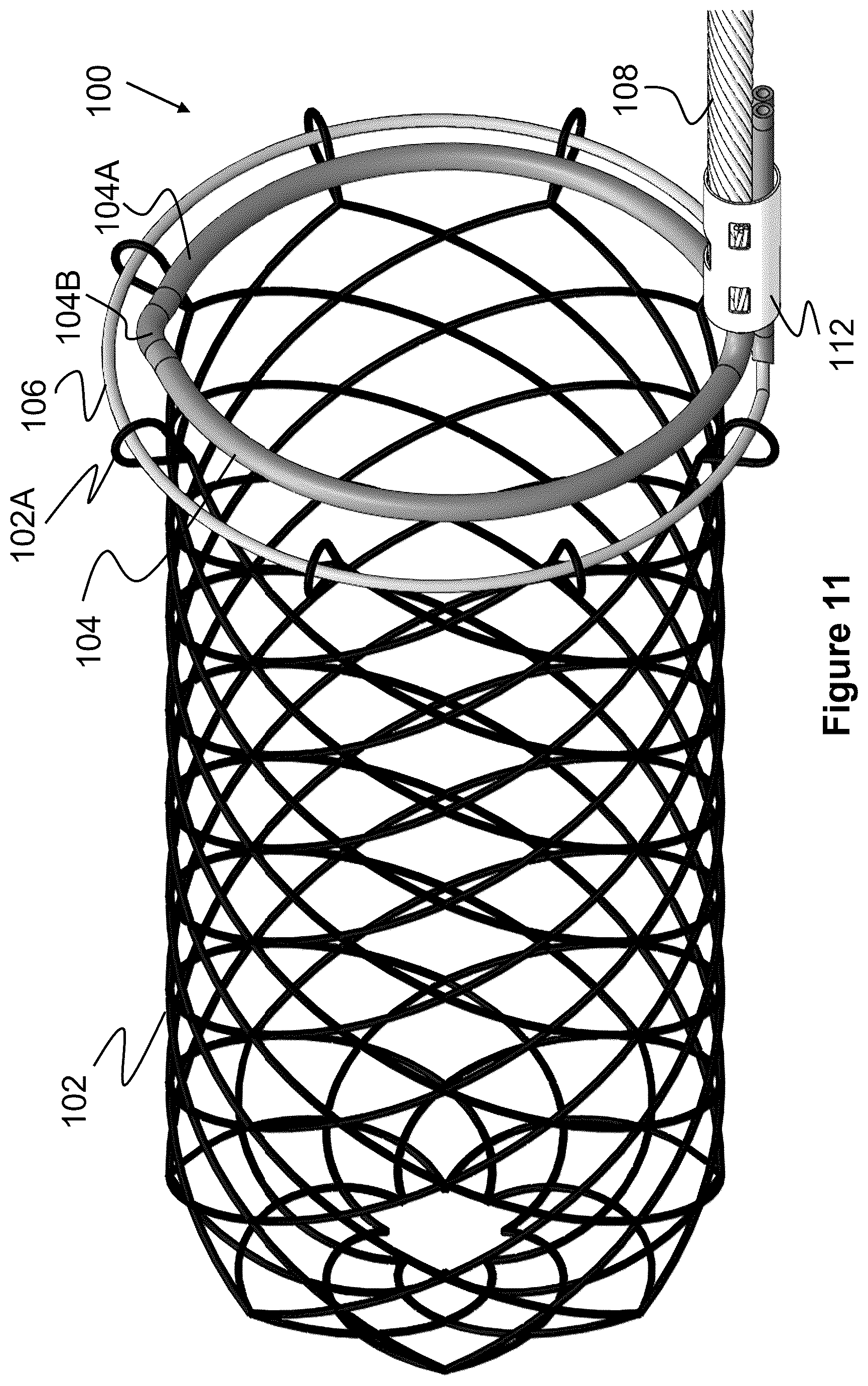 Patent US12569274 Figure 7 – Method and apparatus for removing heart valve therapy