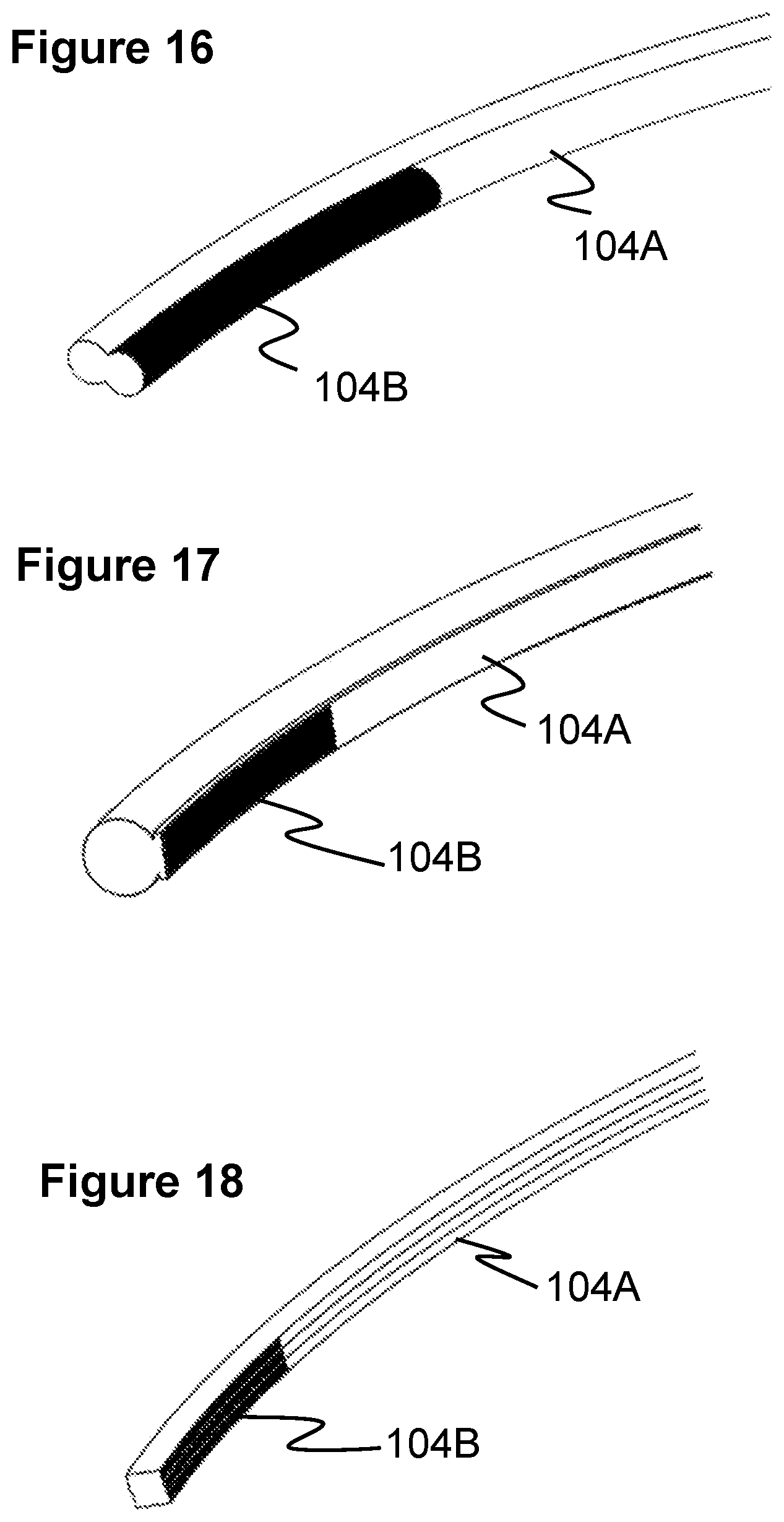 Patent US12569274 Figure 10 – Method and apparatus for removing heart valve therapy