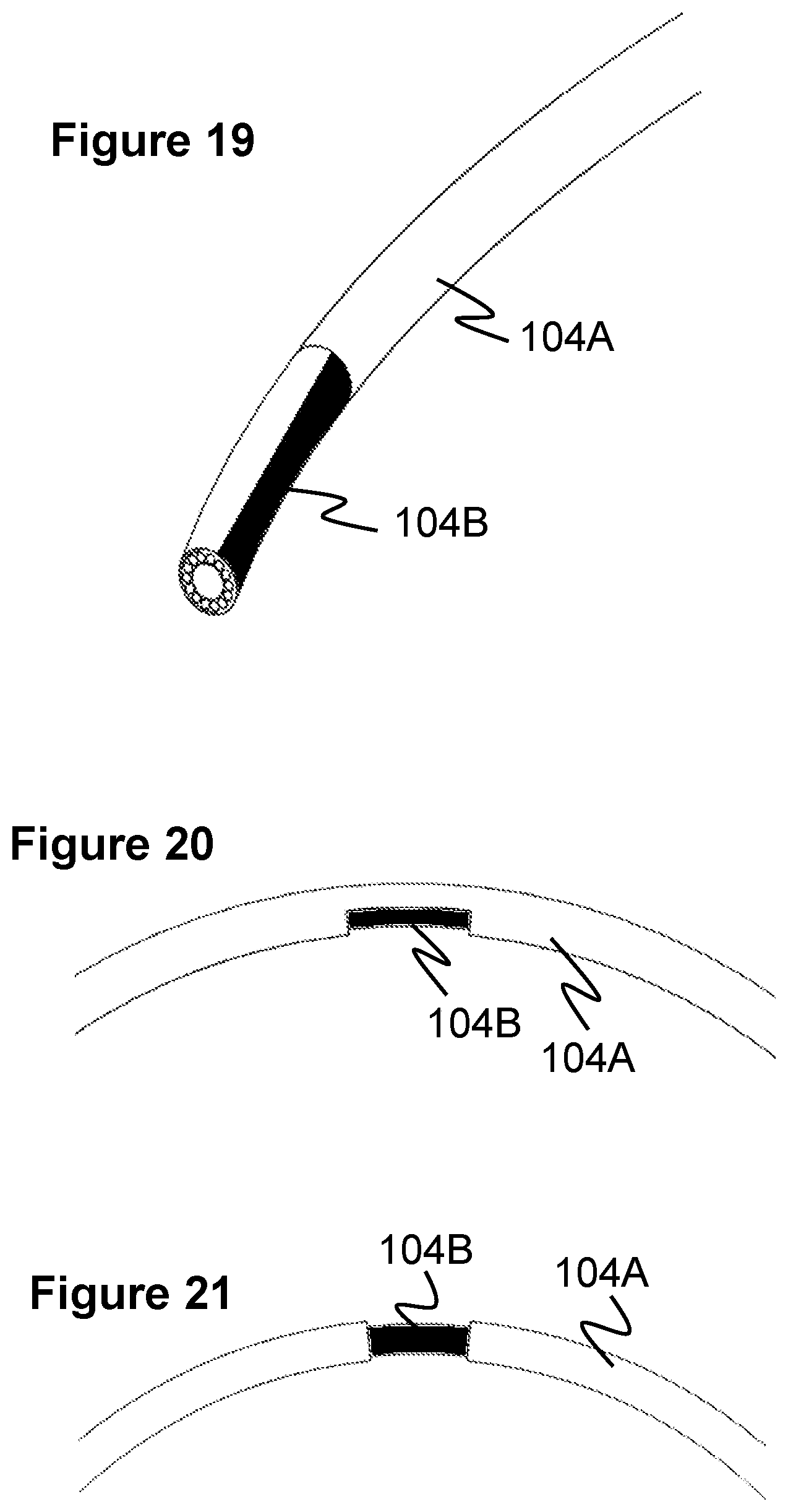 Patent US12569274 Figure 11 – Method and apparatus for removing heart valve therapy