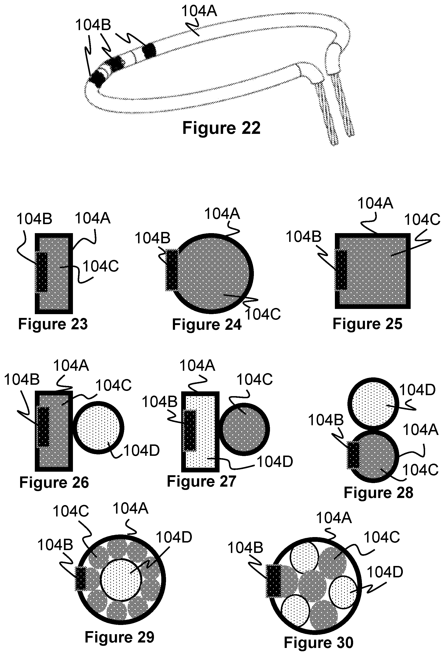 Patent US12569274 Figure 12 – Method and apparatus for removing heart valve therapy