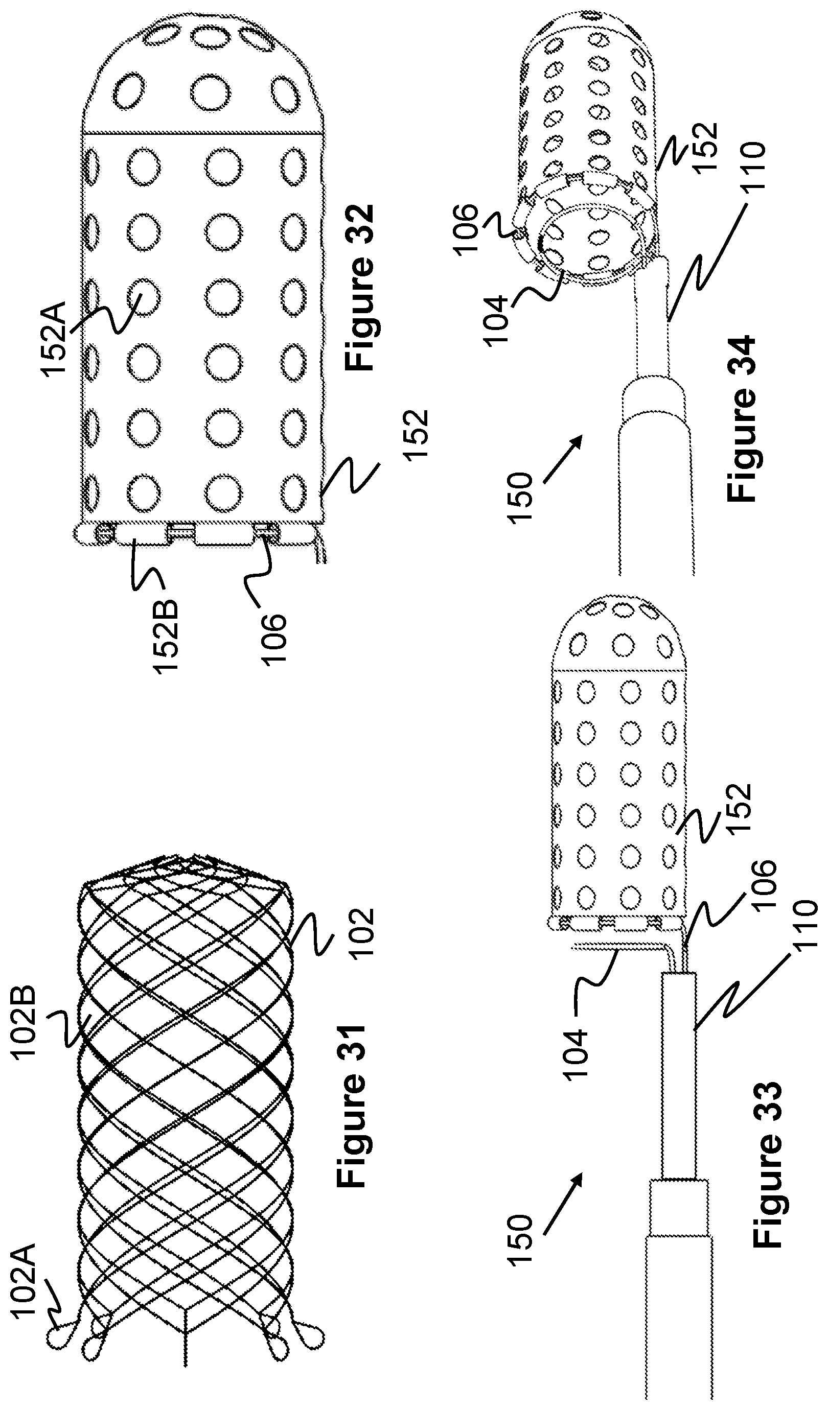 Patent US12569274 Figure 13 – Method and apparatus for removing heart valve therapy