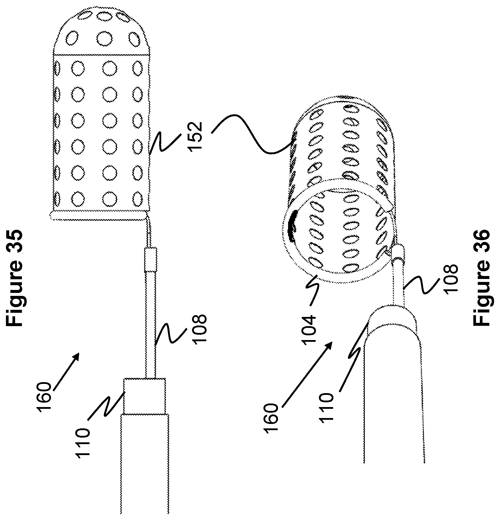 Patent US12569274 Figure 14 – Method and apparatus for removing heart valve therapy