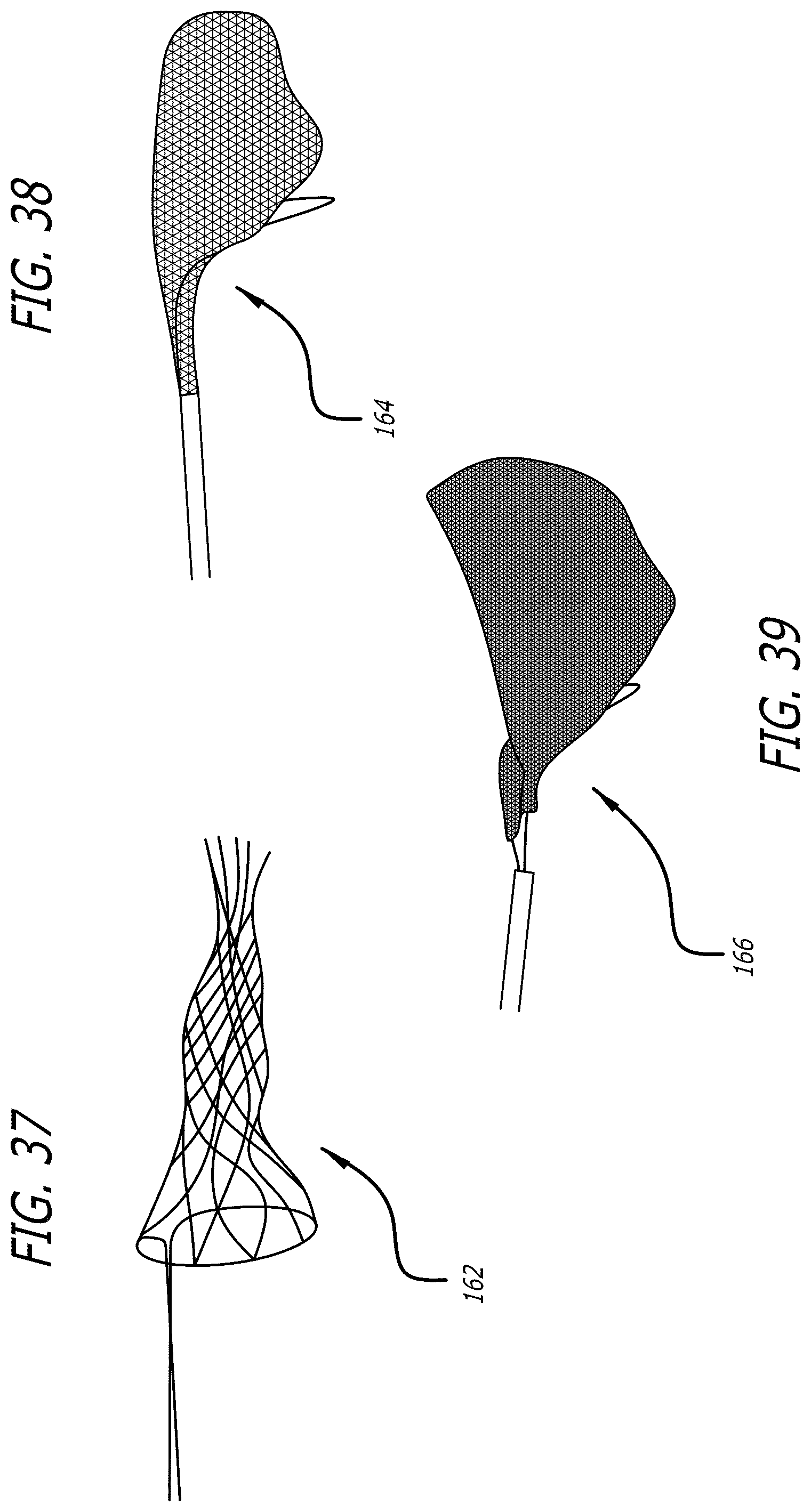 Patent US12569274 Figure 15 – Method and apparatus for removing heart valve therapy