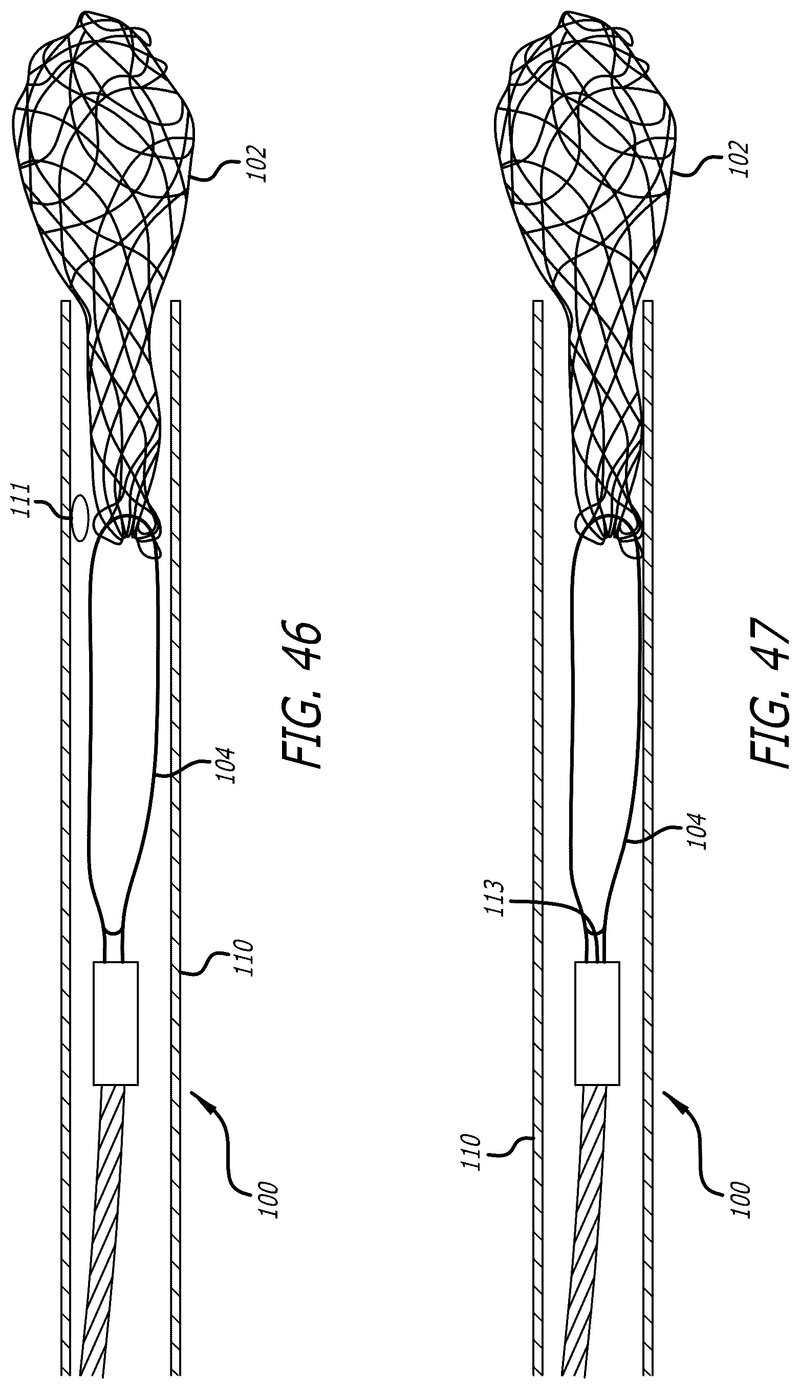 Patent US12569274 Figure 18 – Method and apparatus for removing heart valve therapy