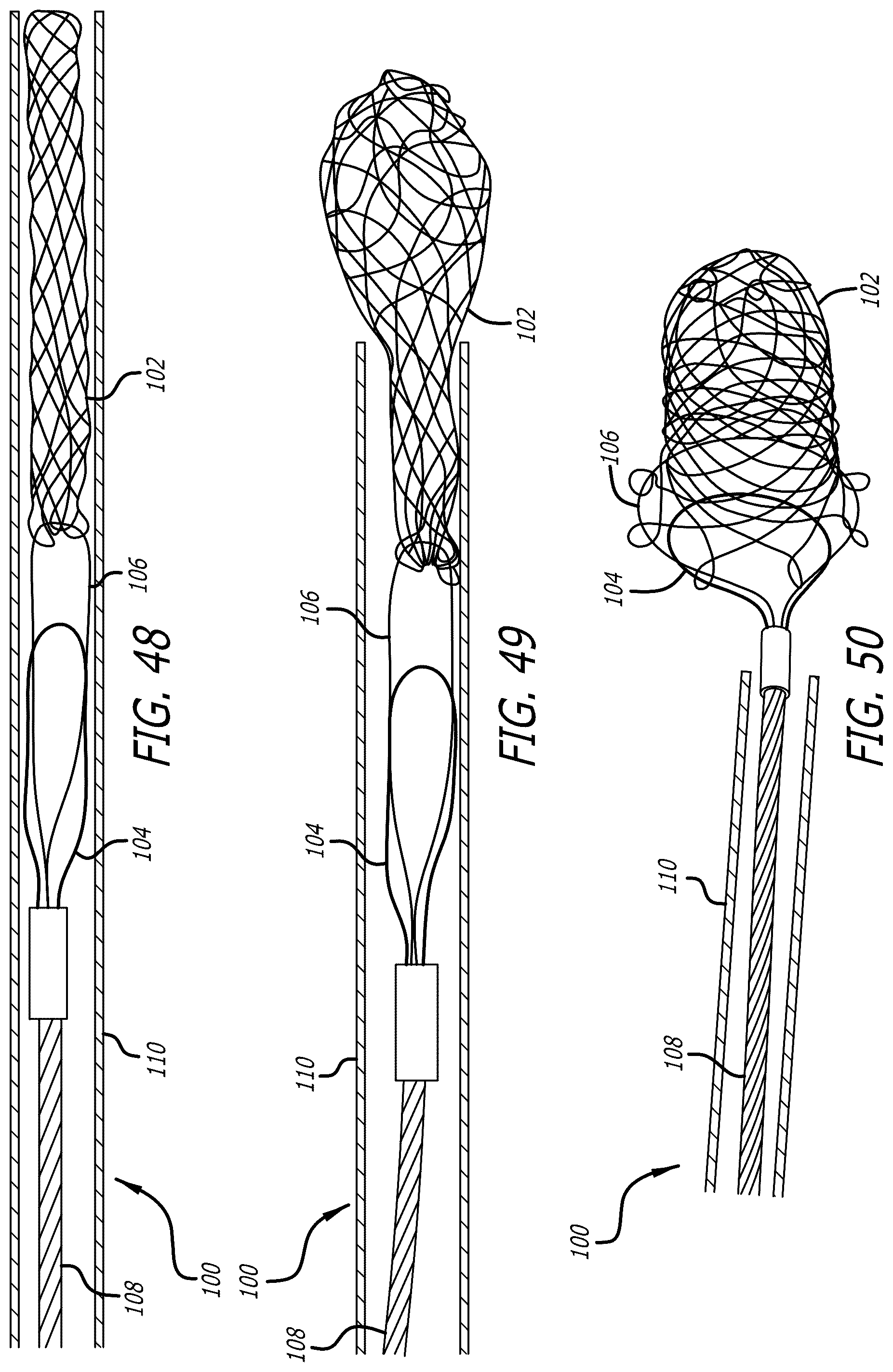 Patent US12569274 Figure 19 – Method and apparatus for removing heart valve therapy