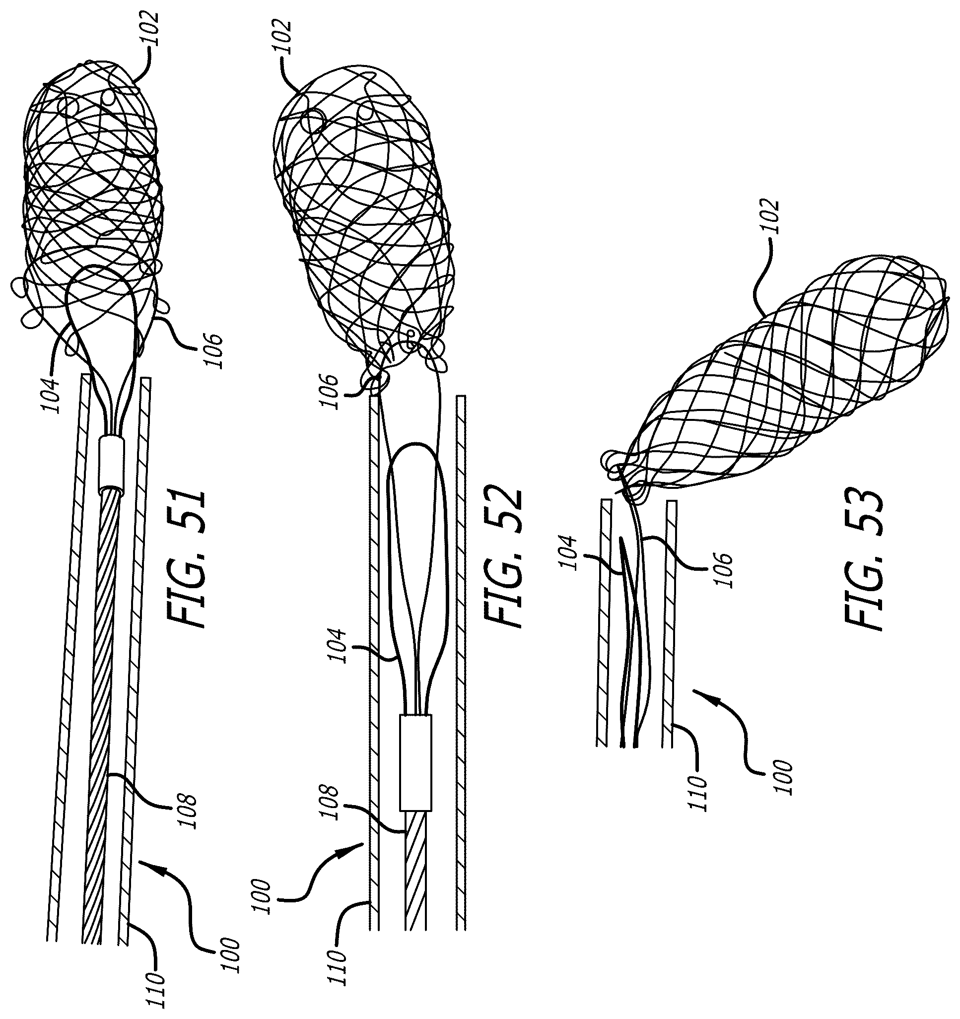 Patent US12569274 Figure 20 – Method and apparatus for removing heart valve therapy