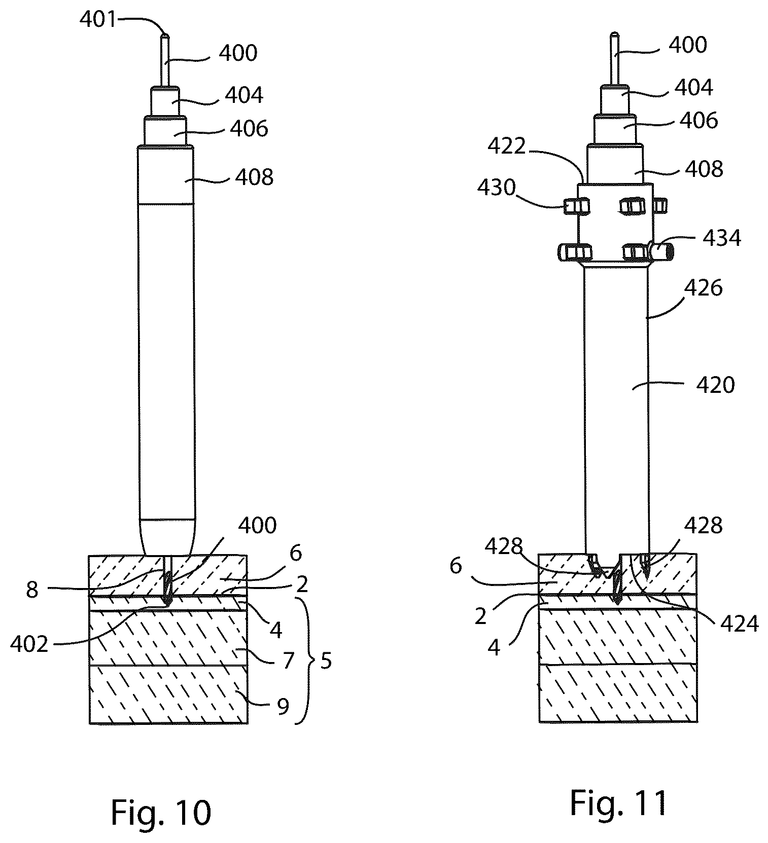 Patent US12569280 Figure 9 – Joint fusion implant and methods