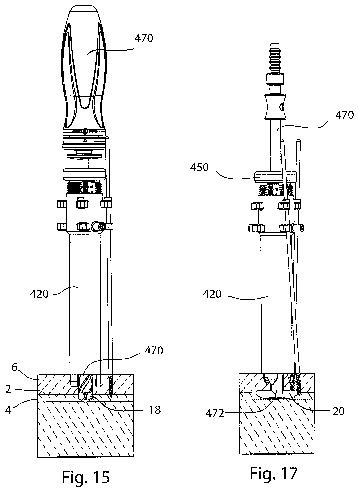 Patent US12569280 Figure 12 – Joint fusion implant and methods