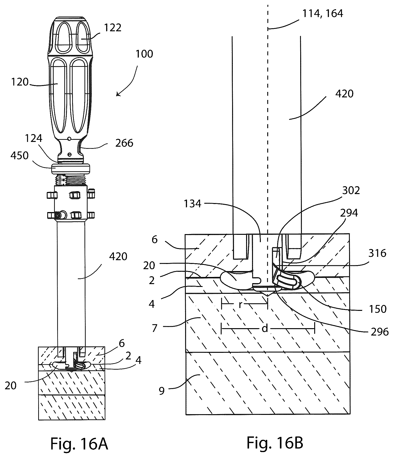 Patent US12569280 Figure 13 – Joint fusion implant and methods