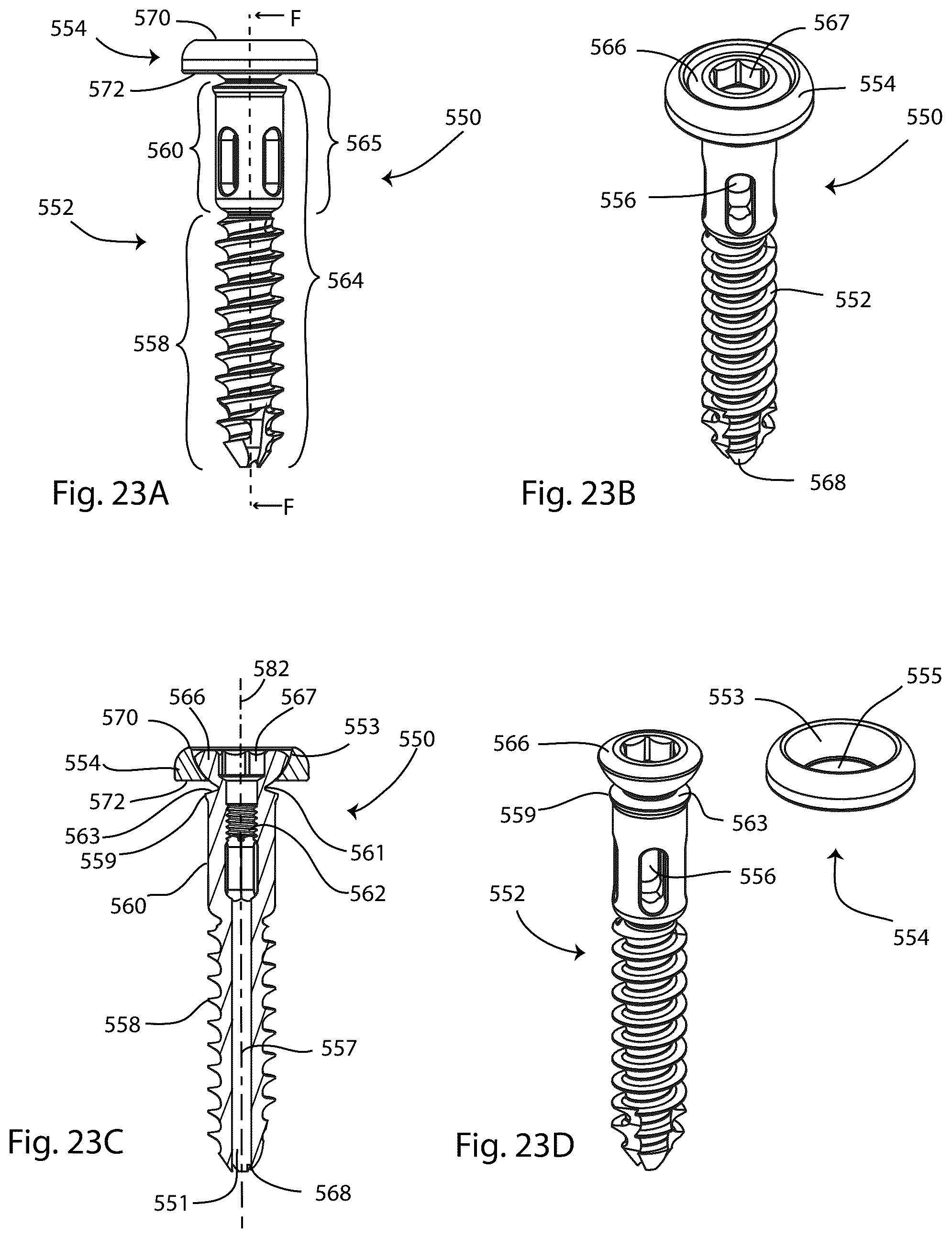 Patent US12569280 Figure 18 – Joint fusion implant and methods
