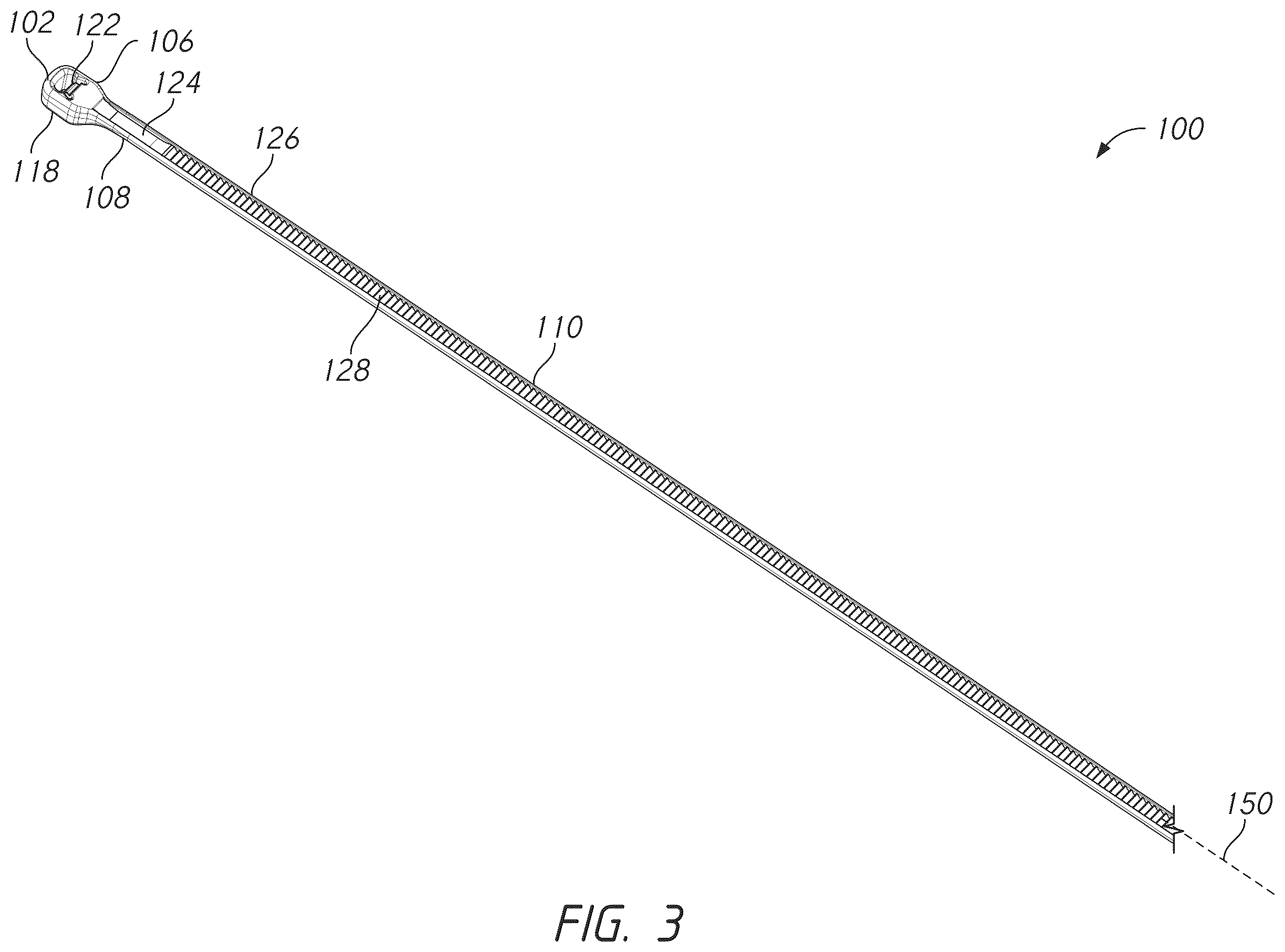 Patent US12569281 Figure 3 – Bone tie and bone tie inserter