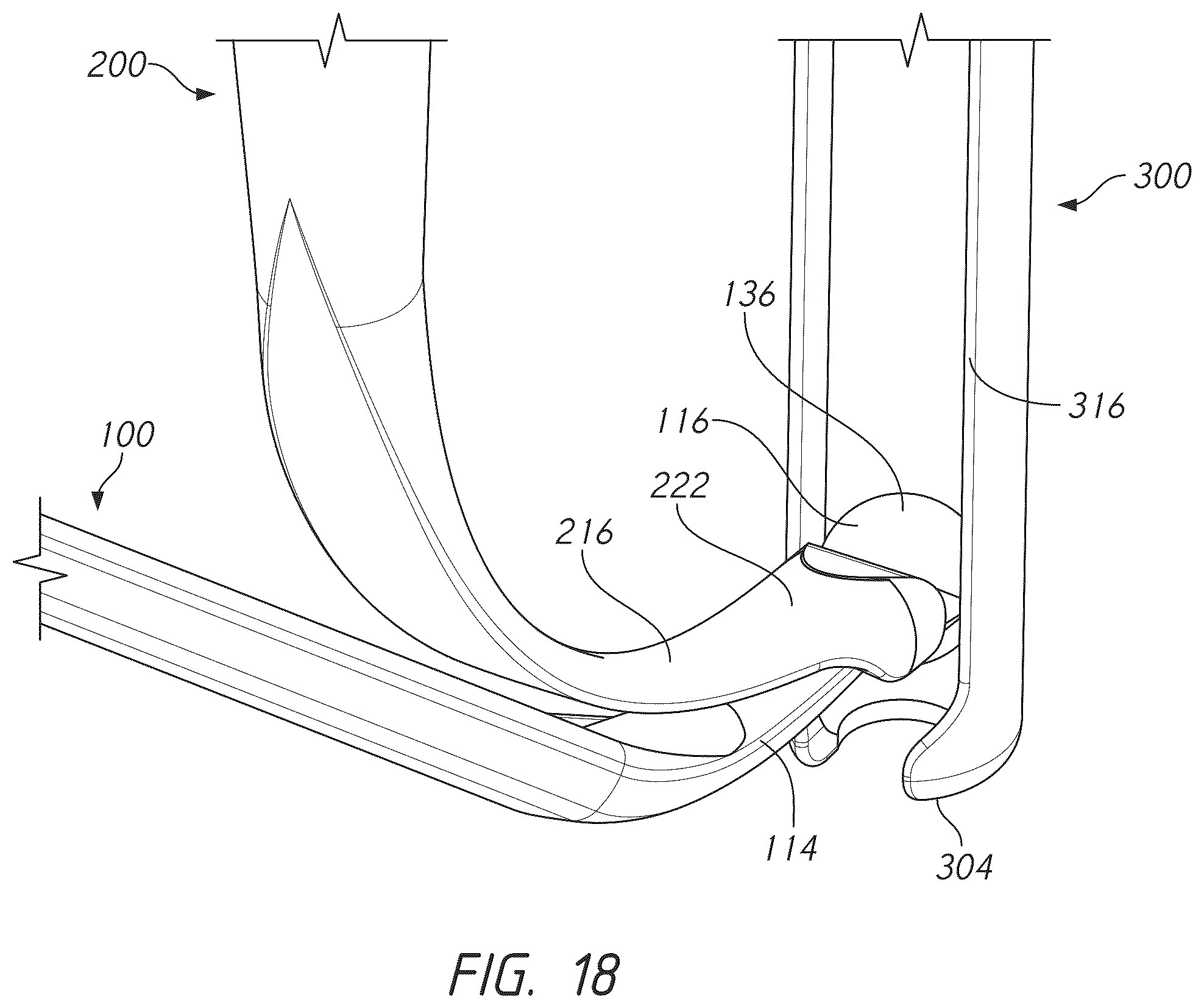 Patent US12569281 Figure 18 – Bone tie and bone tie inserter